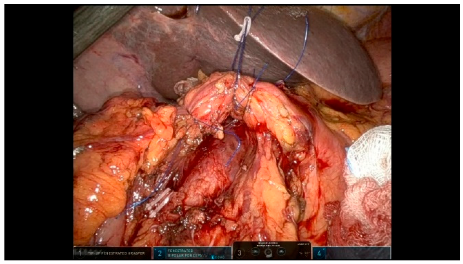 Curroncol 32 00302 g009