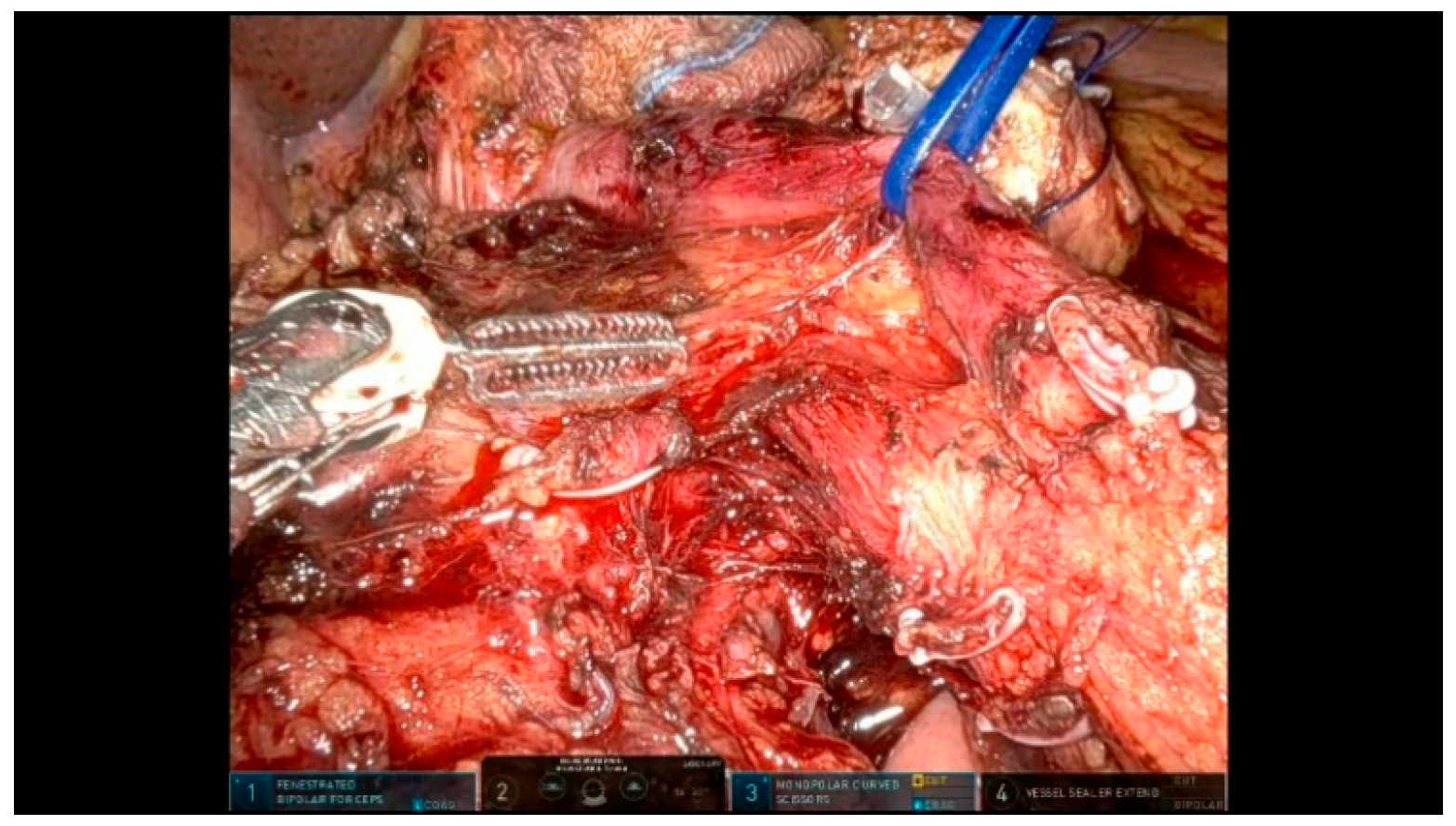 Curroncol 32 00302 g010