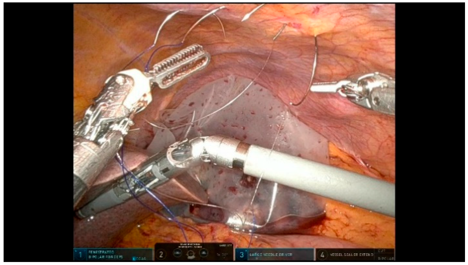 Curroncol 32 00302 g011