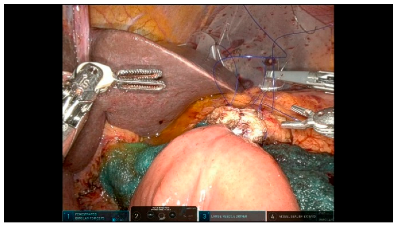 Curroncol 32 00302 g012