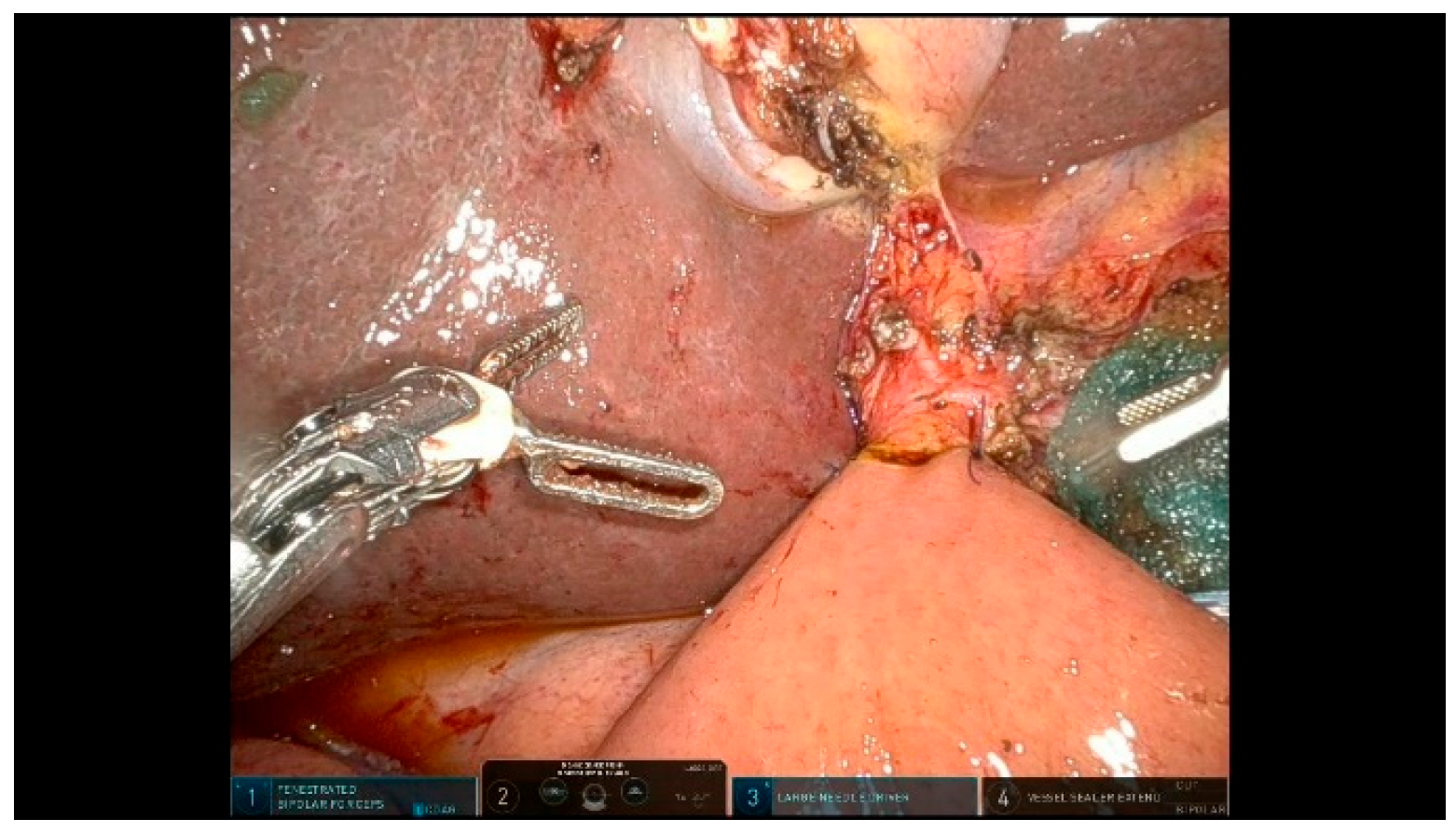 Curroncol 32 00302 g013