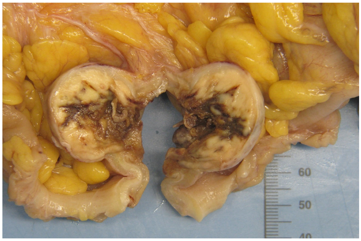 Curroncol 32 00330 g003