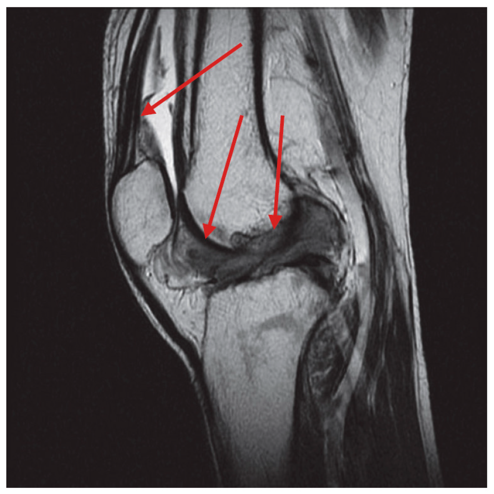 健康・医学 MRI ARTHROSCOPY and SURGICAL ANATOMY Mri, Arthroscopy, and Surgical Anatomy of the Joints