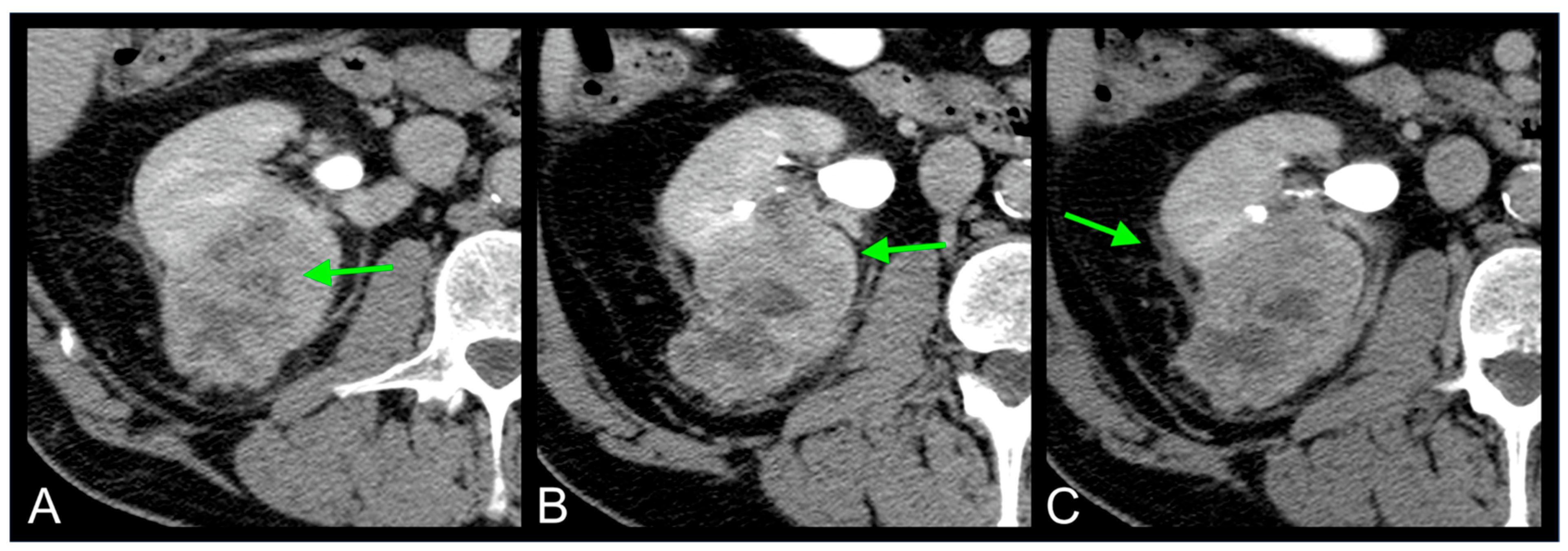 Curroncol 32 00348 g006