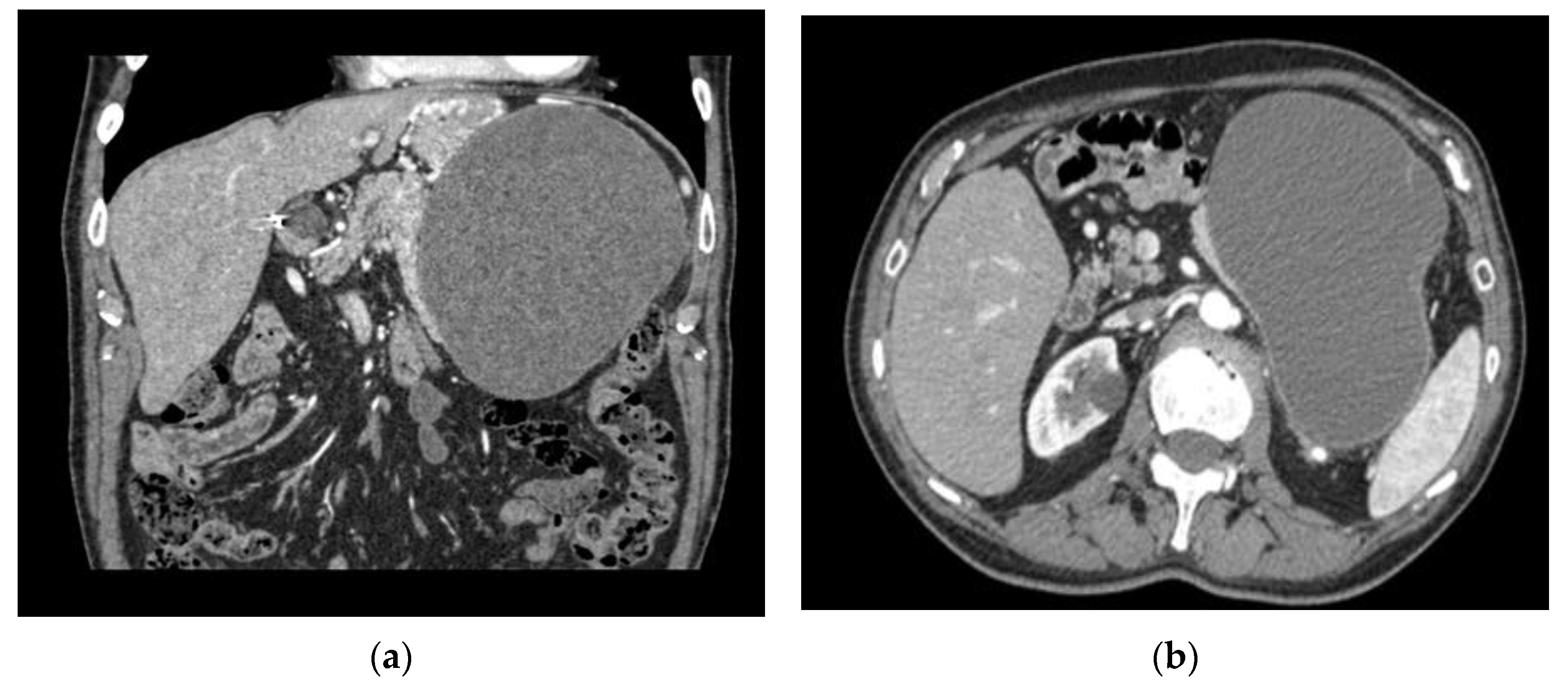 Curroncol 32 00352 g001a