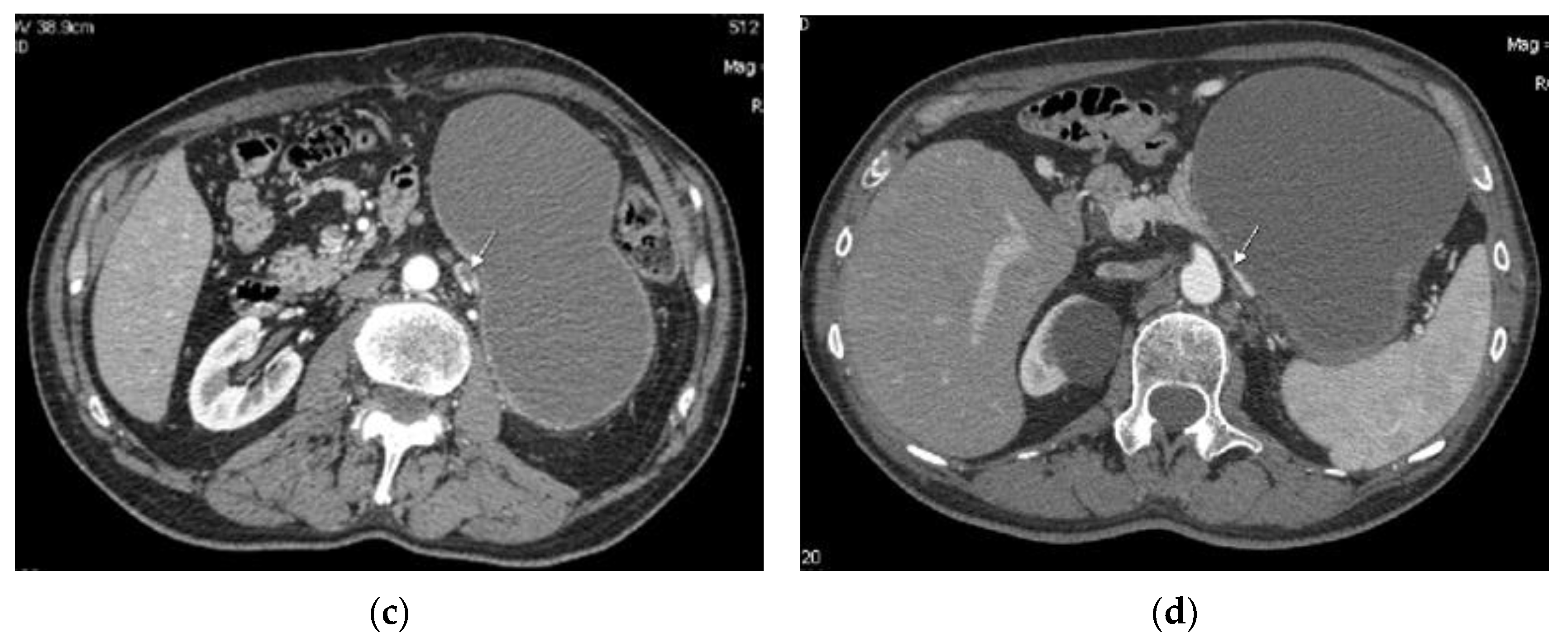 Curroncol 32 00352 g001b