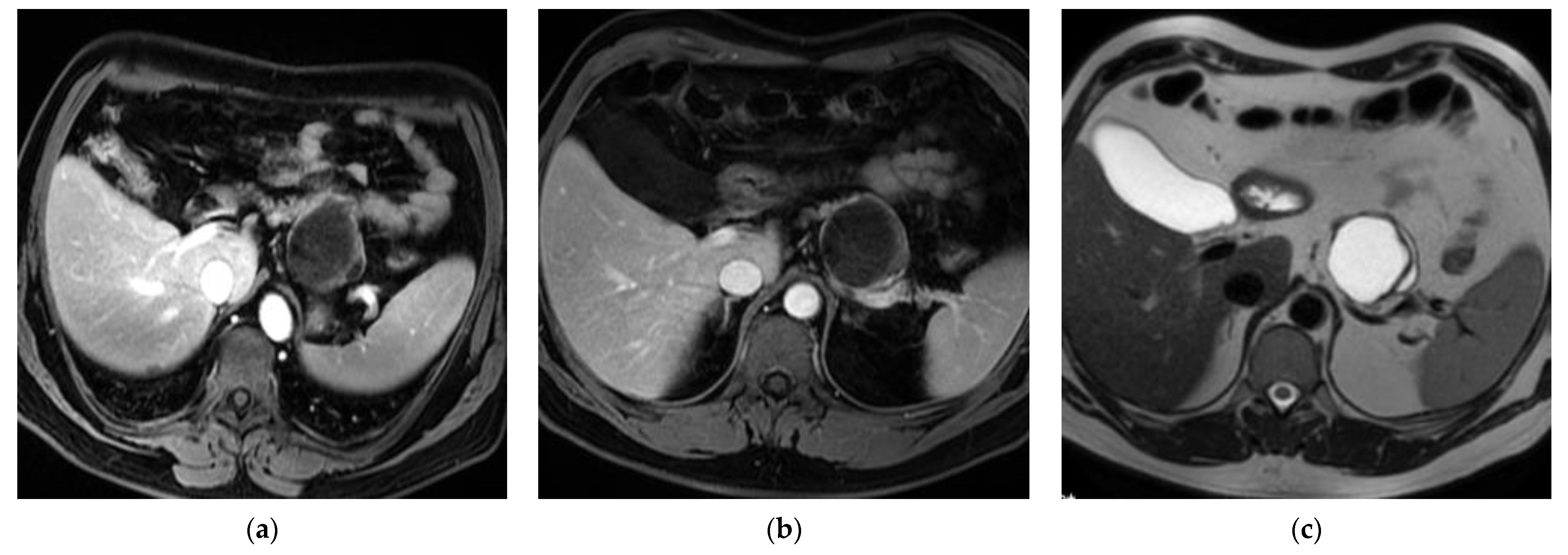 Curroncol 32 00352 g003