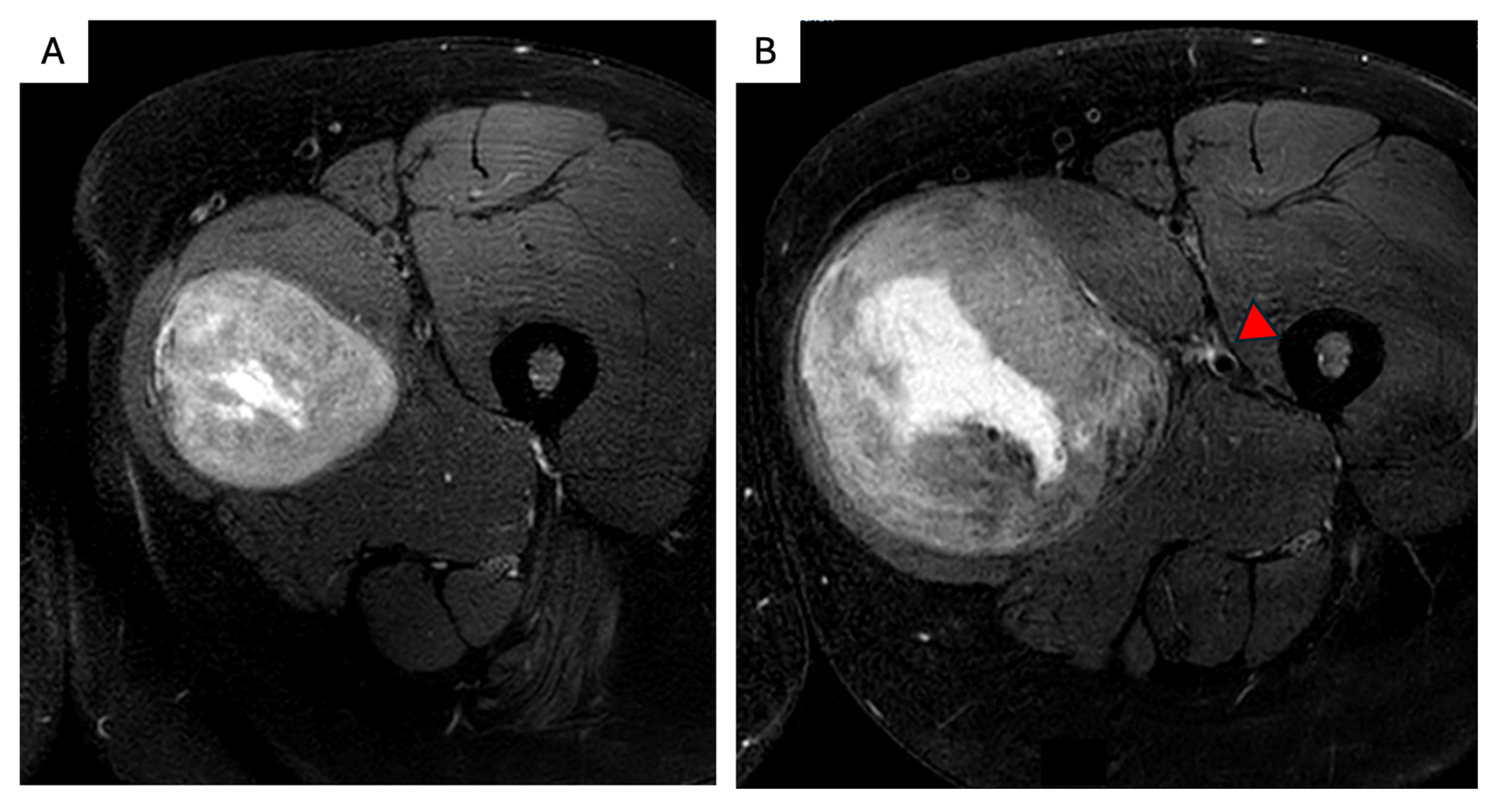 Curroncol 32 00408 g005