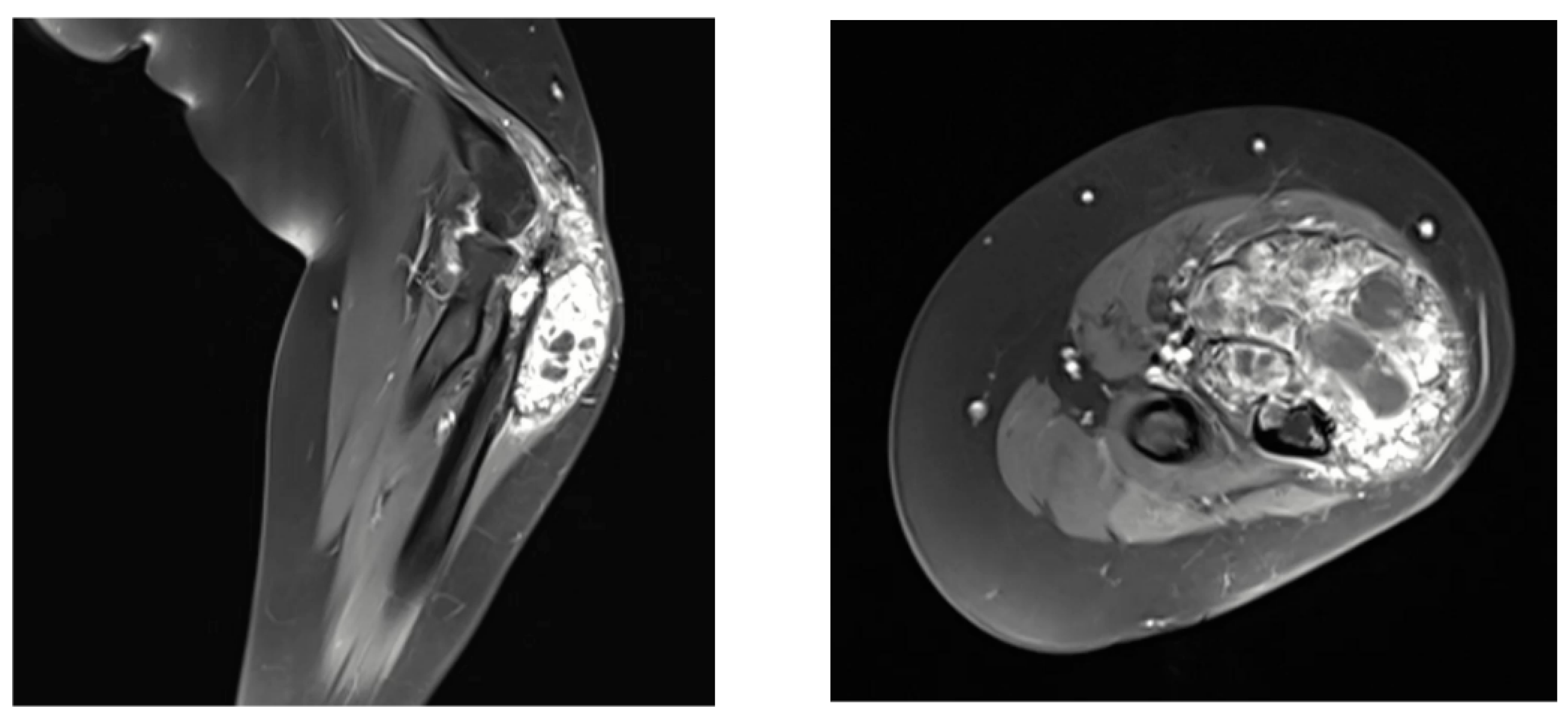 Curroncol 32 00411 g002