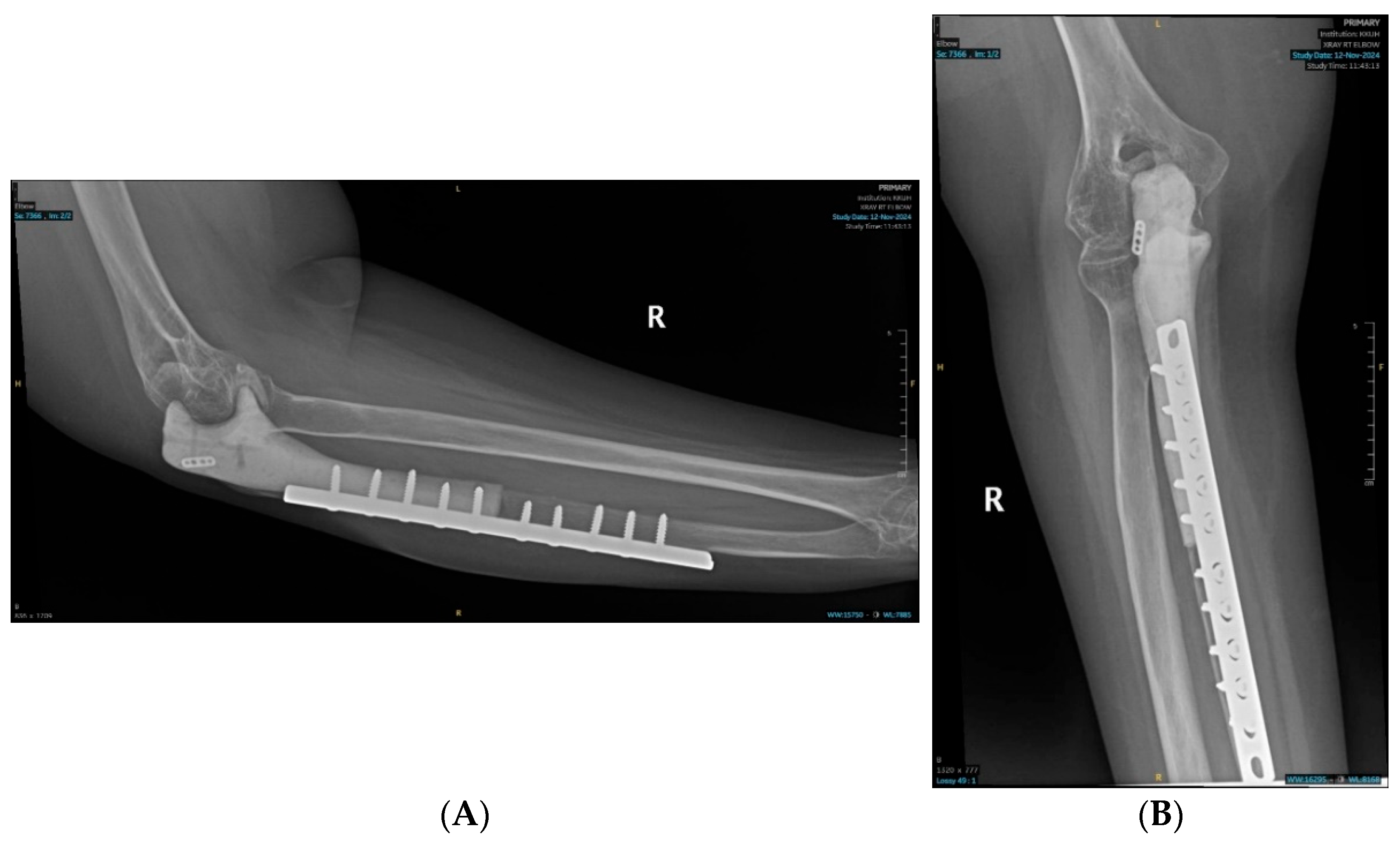 Curroncol 32 00411 g007