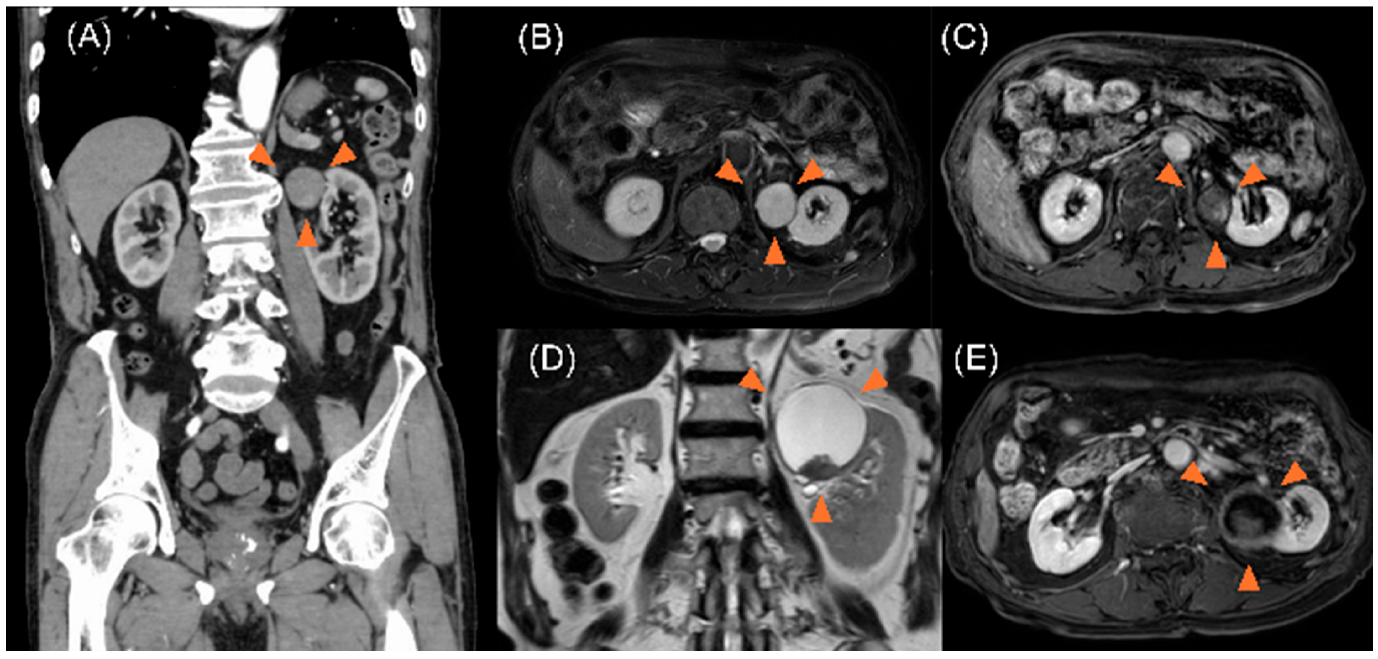 Curroncol 32 00500 g001 Curroncol 32 00500 g001