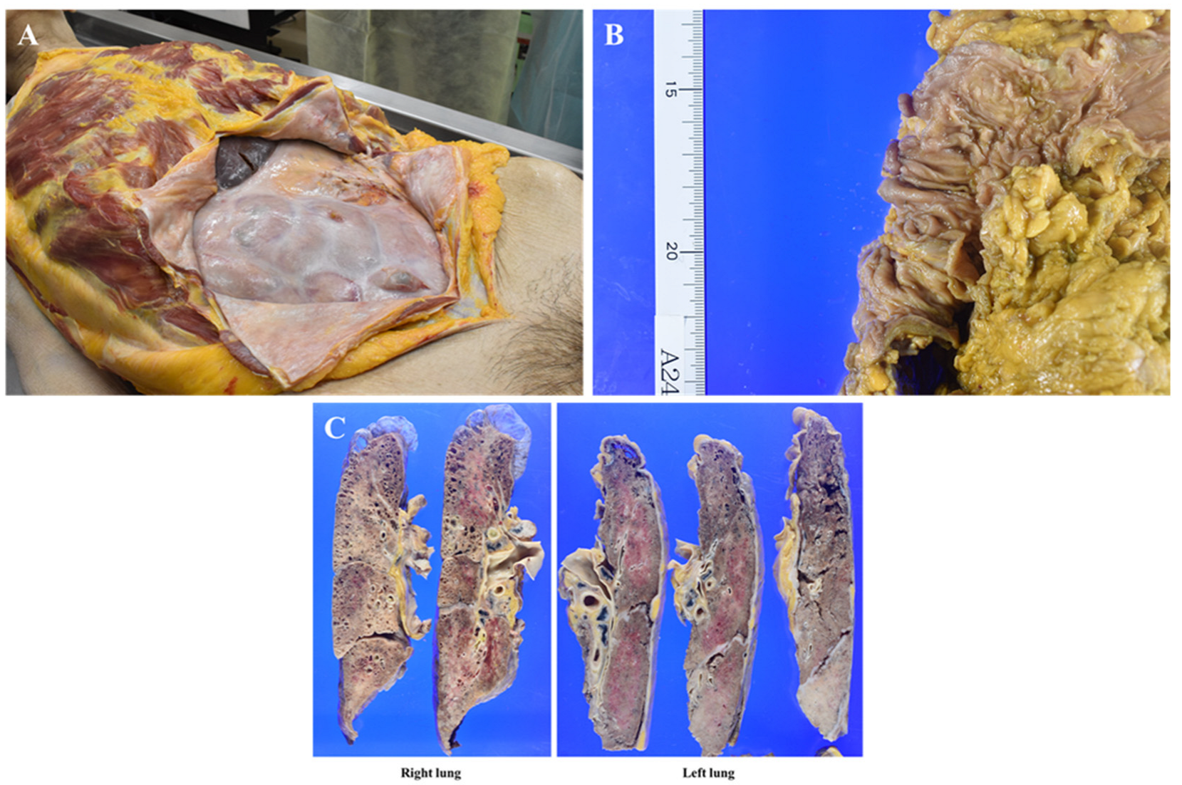 Curroncol 32 00506 g004