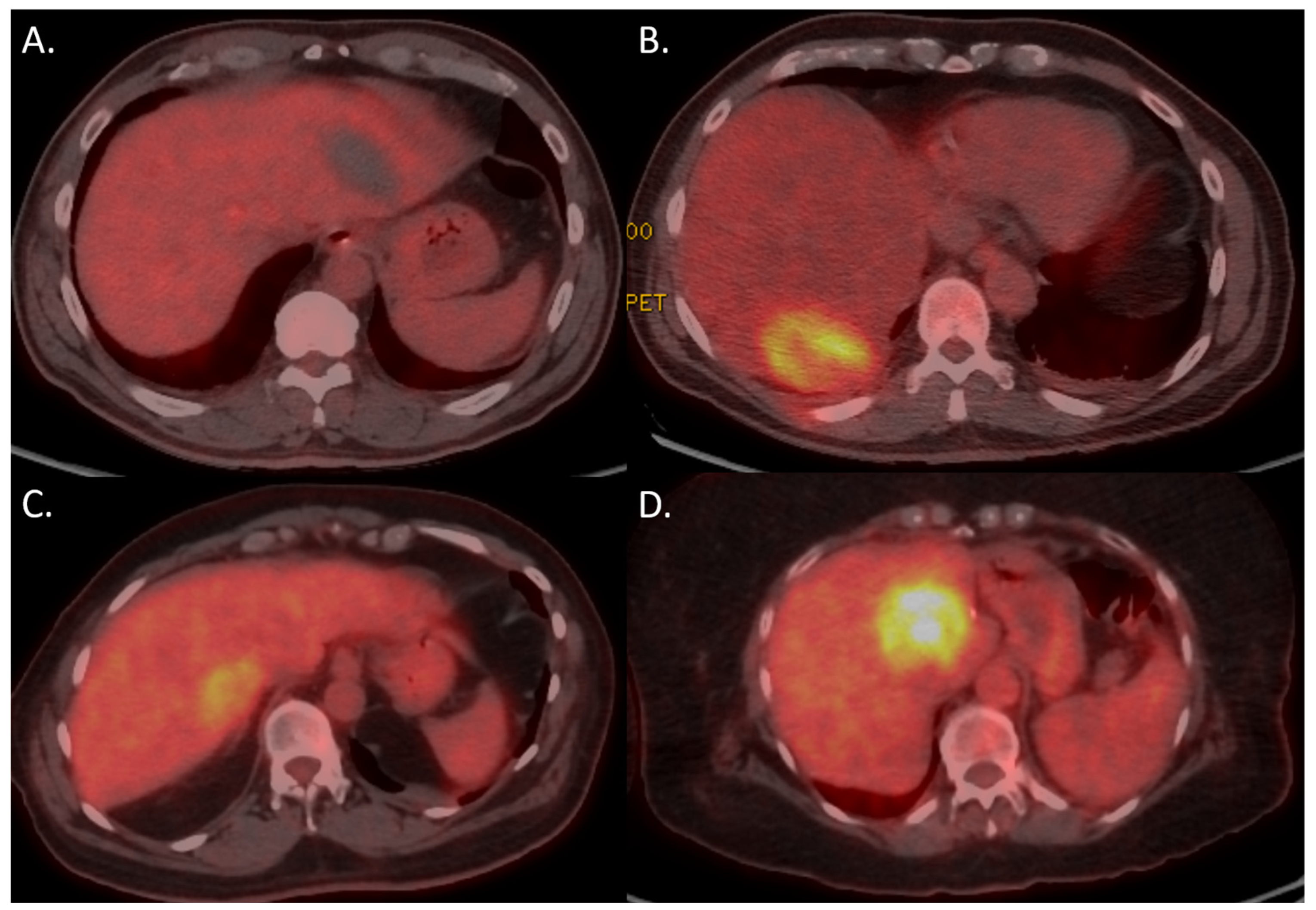 Curroncol 32 00521 g003