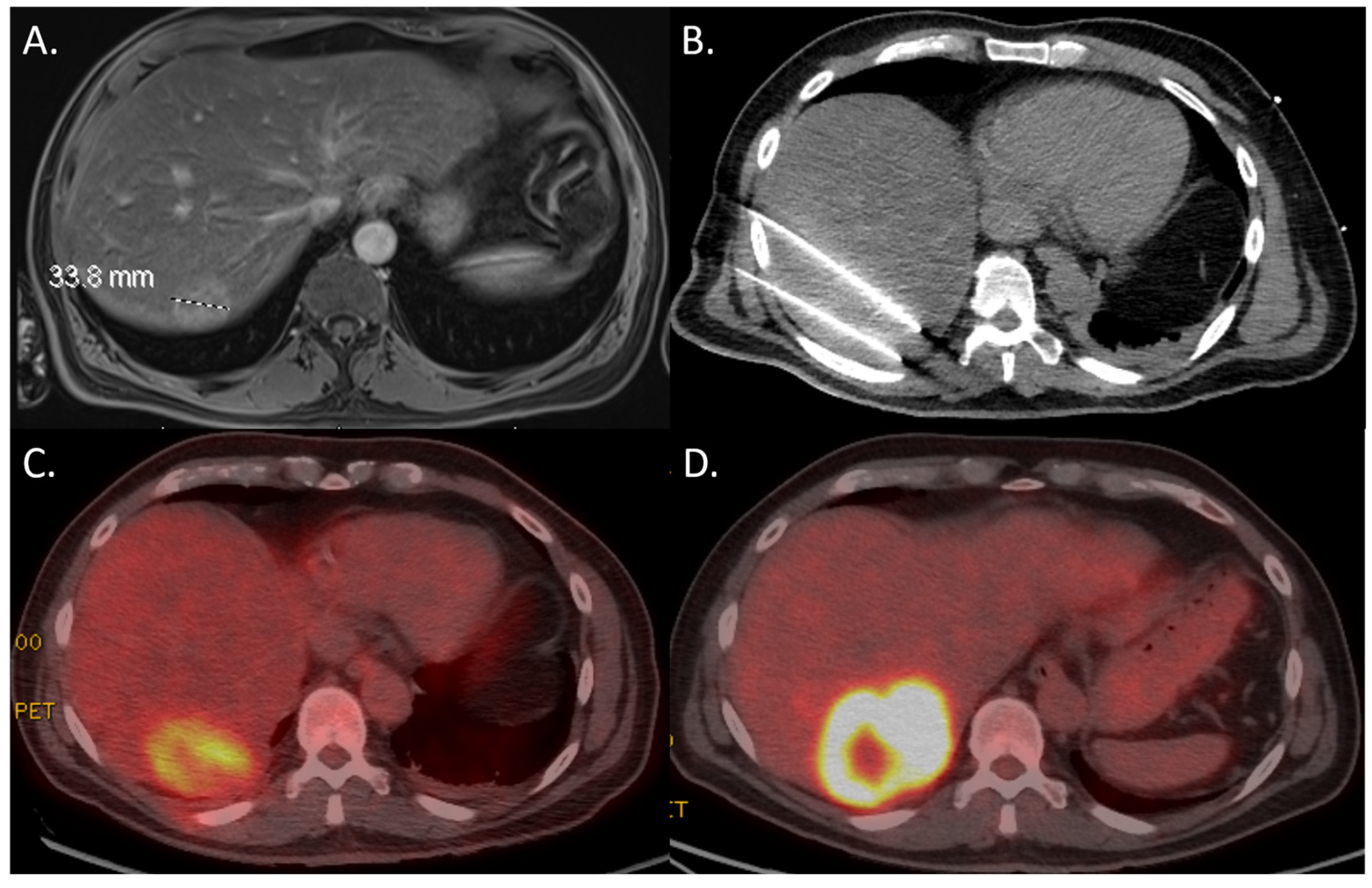 Curroncol 32 00521 g004