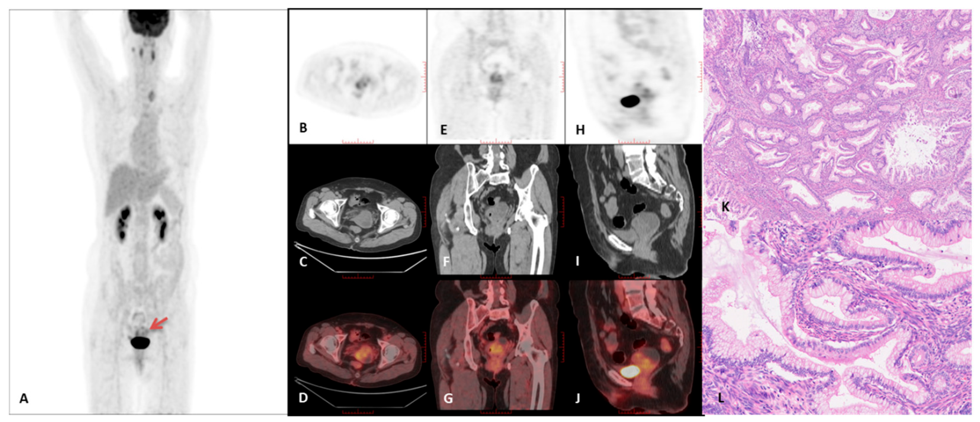 Curroncol 32 00530 g003 Curroncol 32 00530 g003