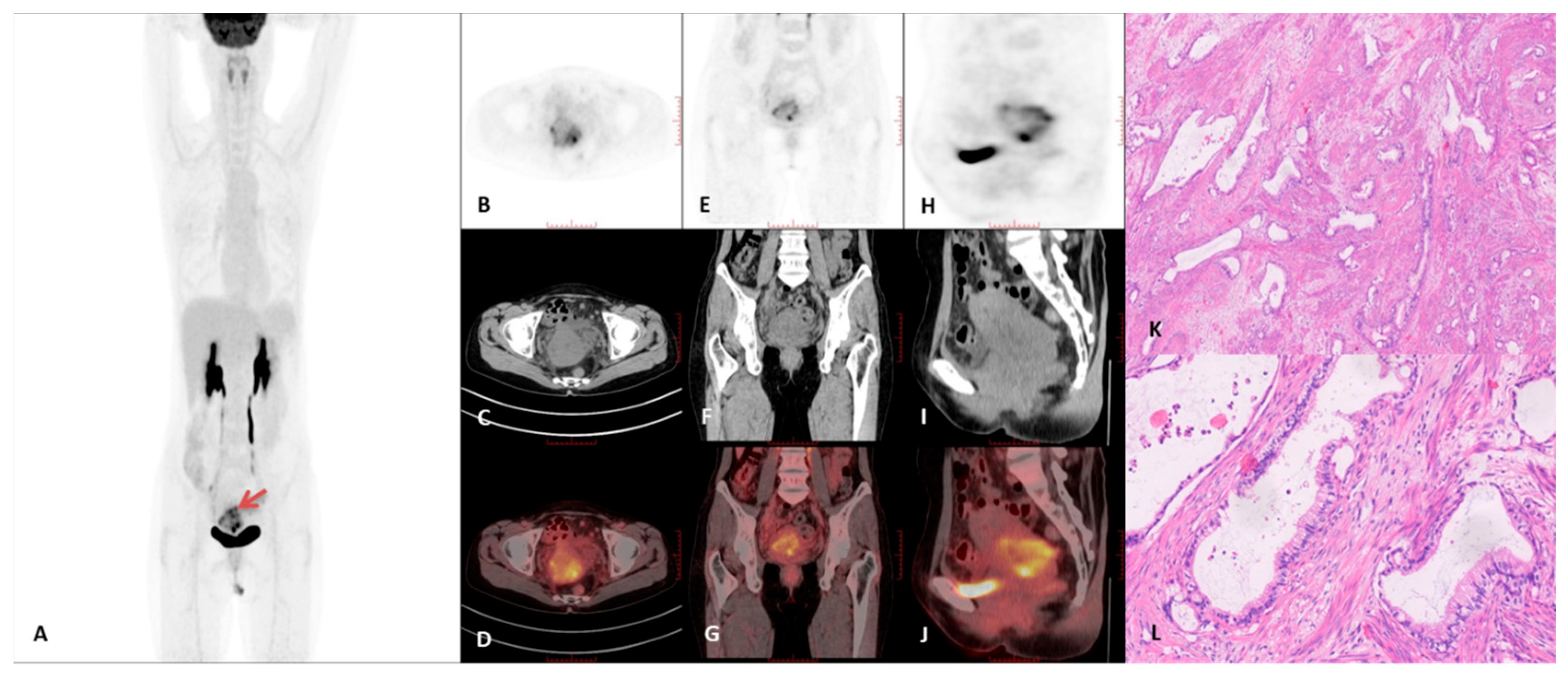 Curroncol 32 00530 g004 Curroncol 32 00530 g004