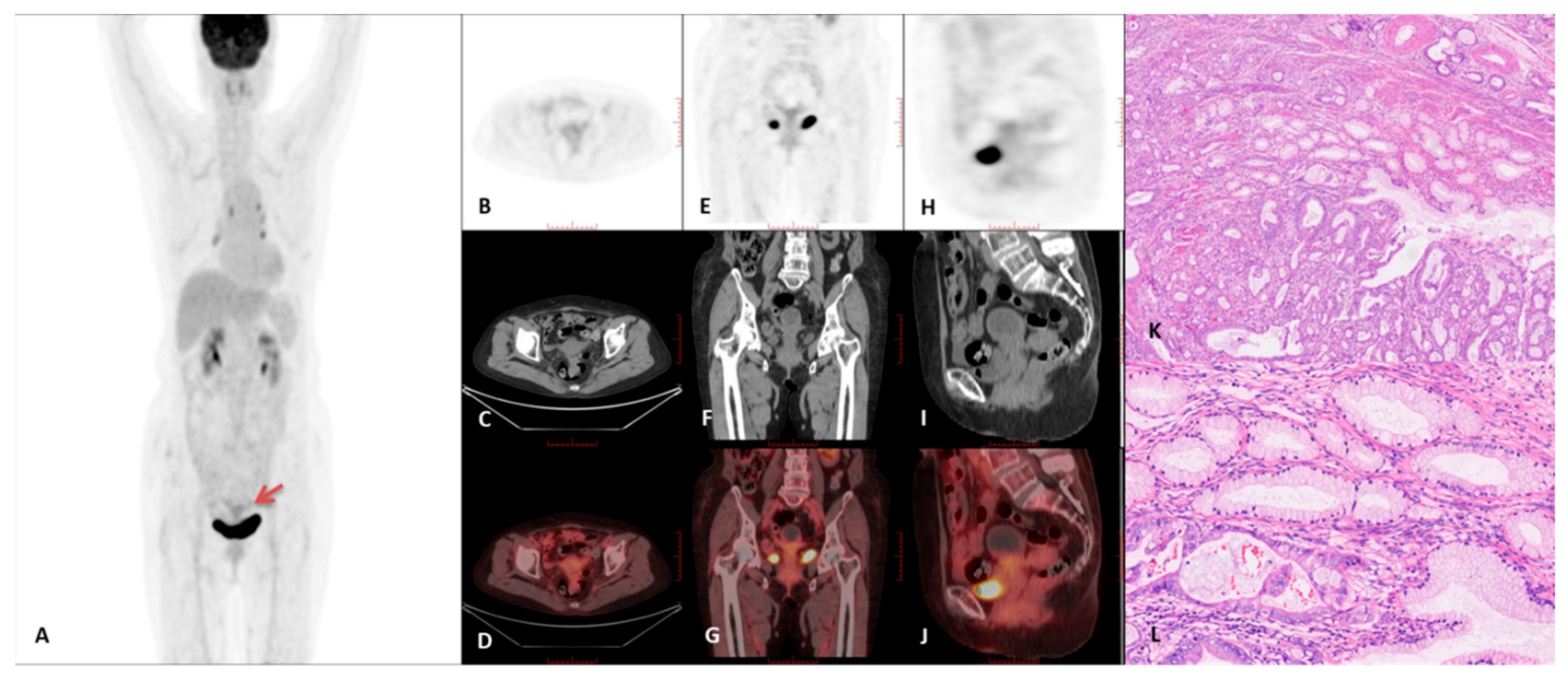 Curroncol 32 00530 g005 Curroncol 32 00530 g005