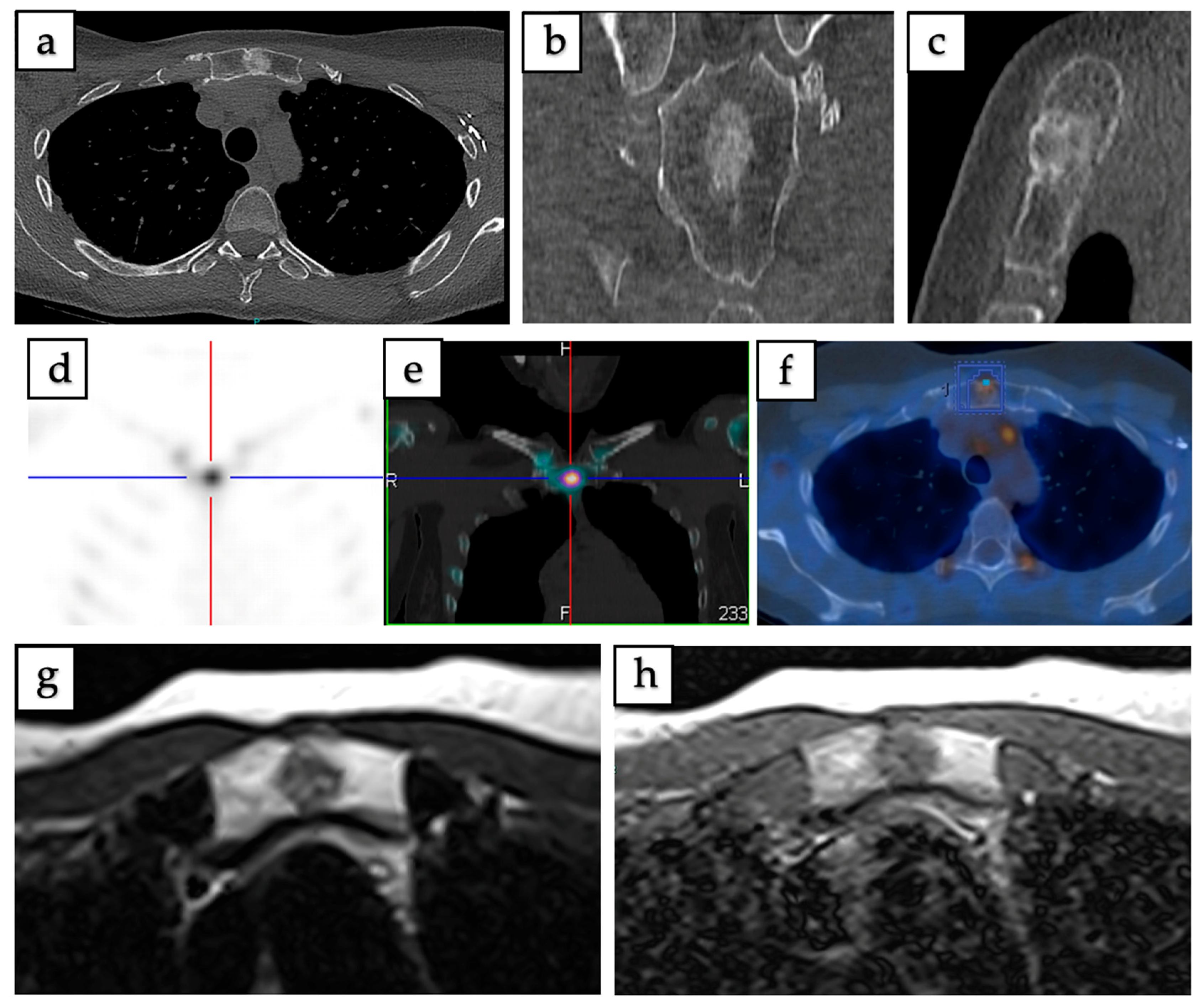 Curroncol 32 00535 g003 Curroncol 32 00535 g003
