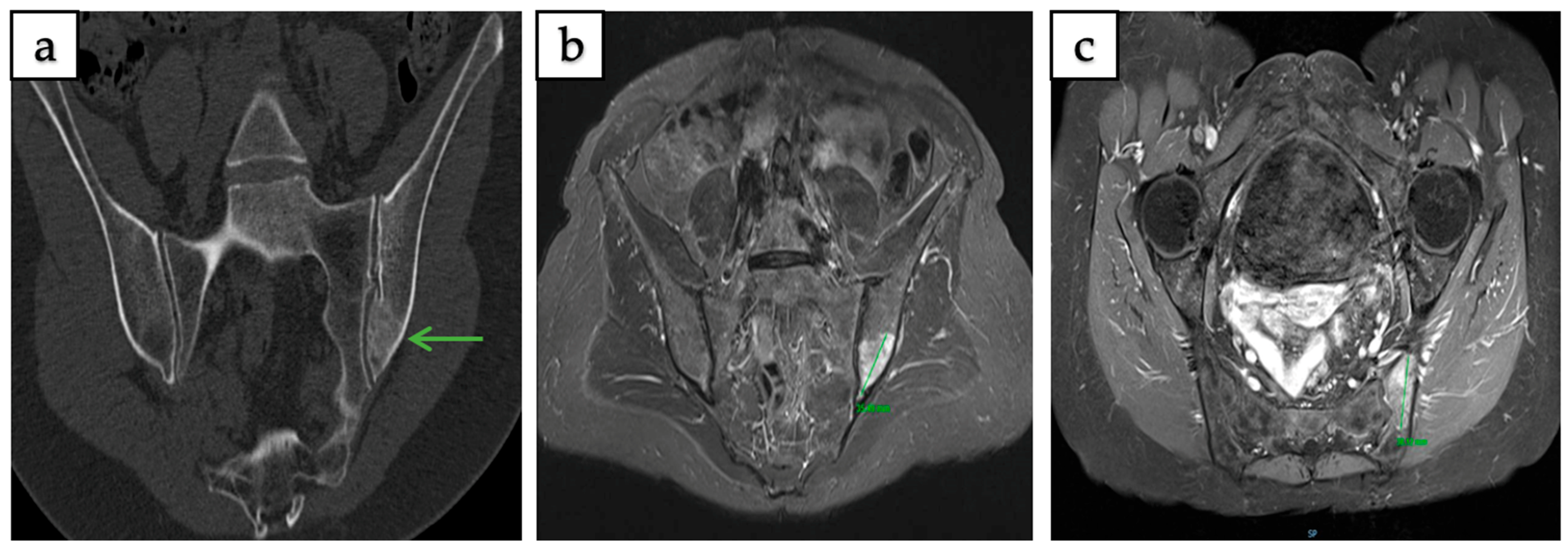 Curroncol 32 00535 g004 Curroncol 32 00535 g004