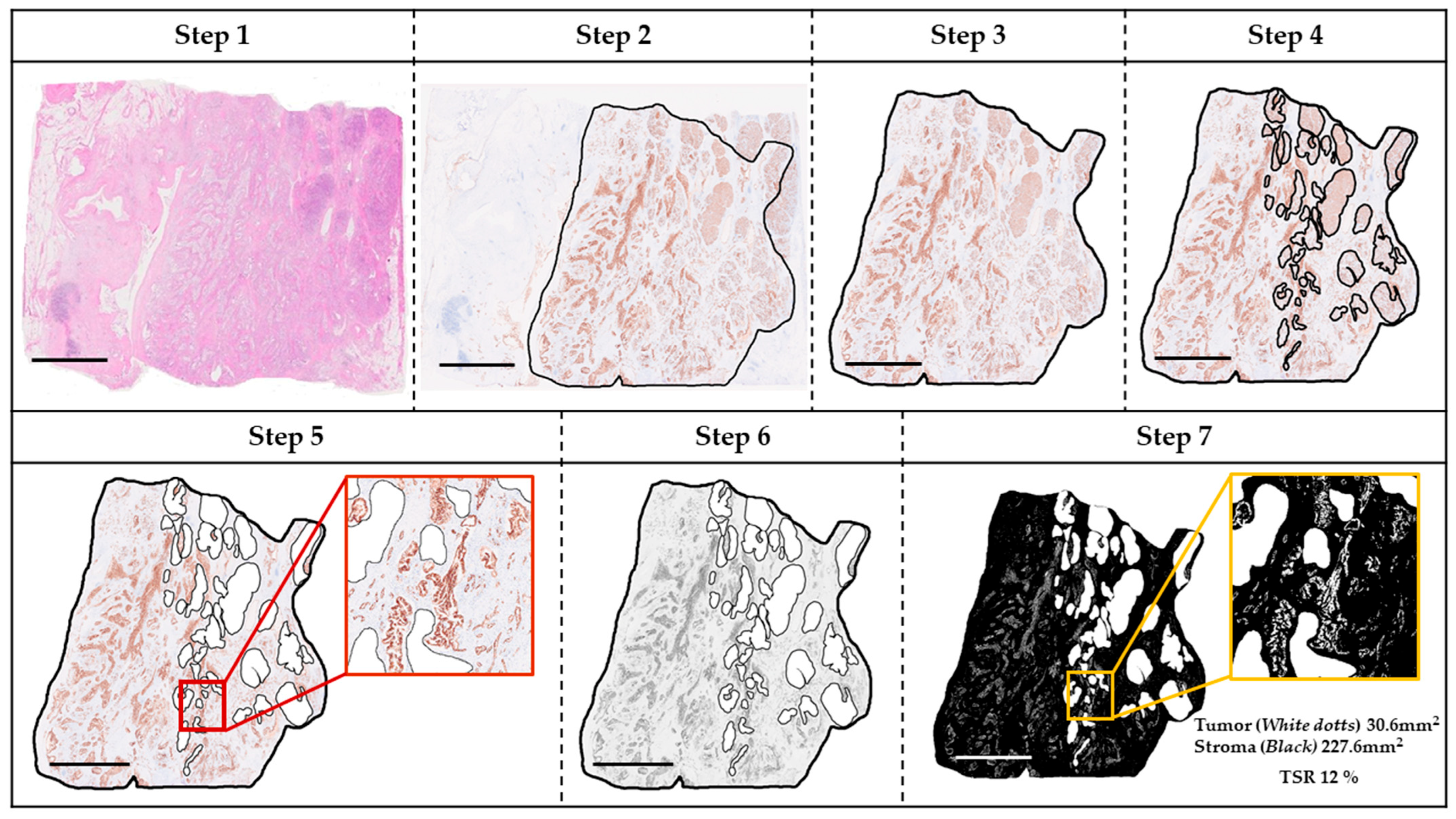 Curroncol 32 00578 g001 Curroncol 32 00578 g001