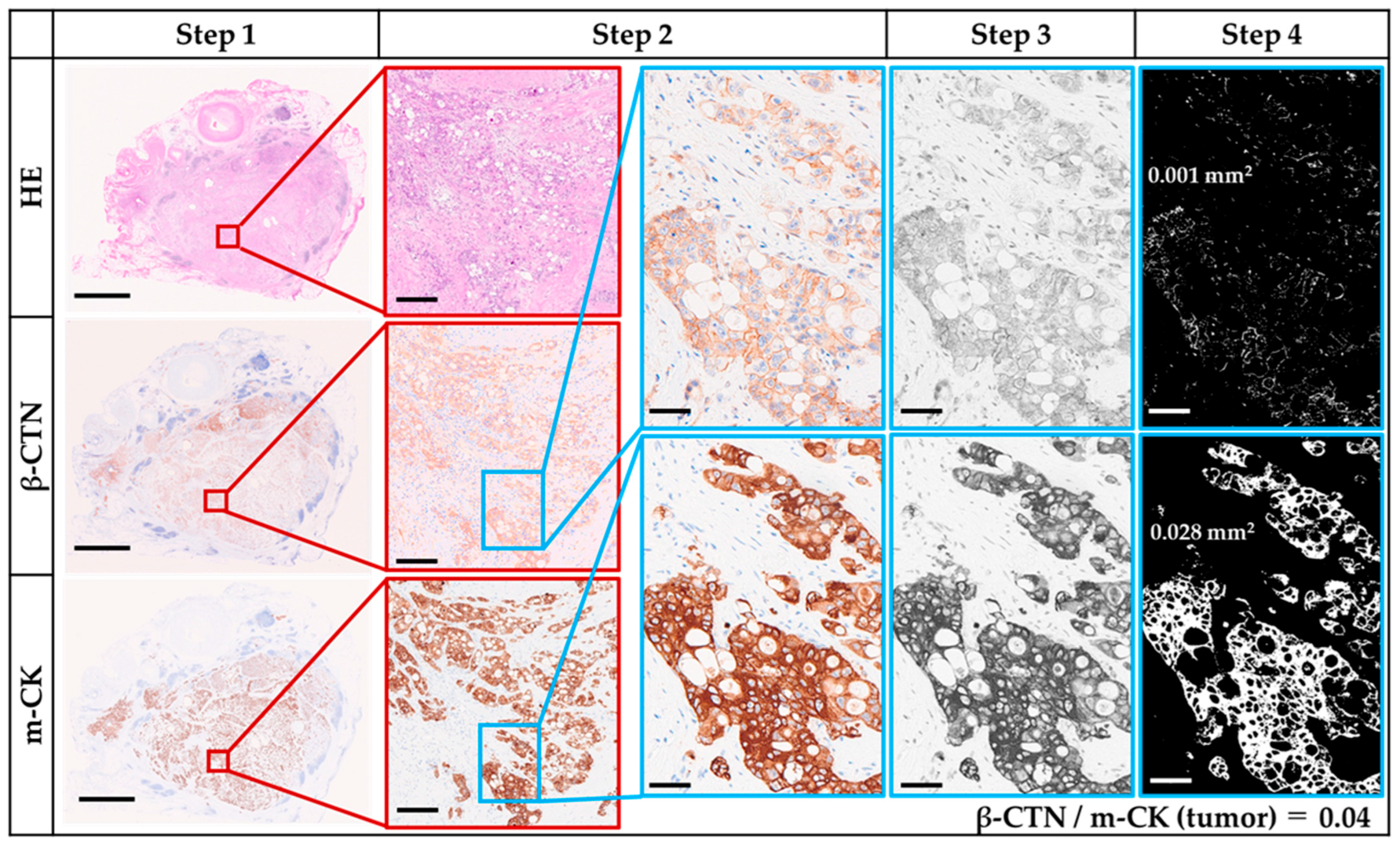 Curroncol 32 00578 g002 Curroncol 32 00578 g002