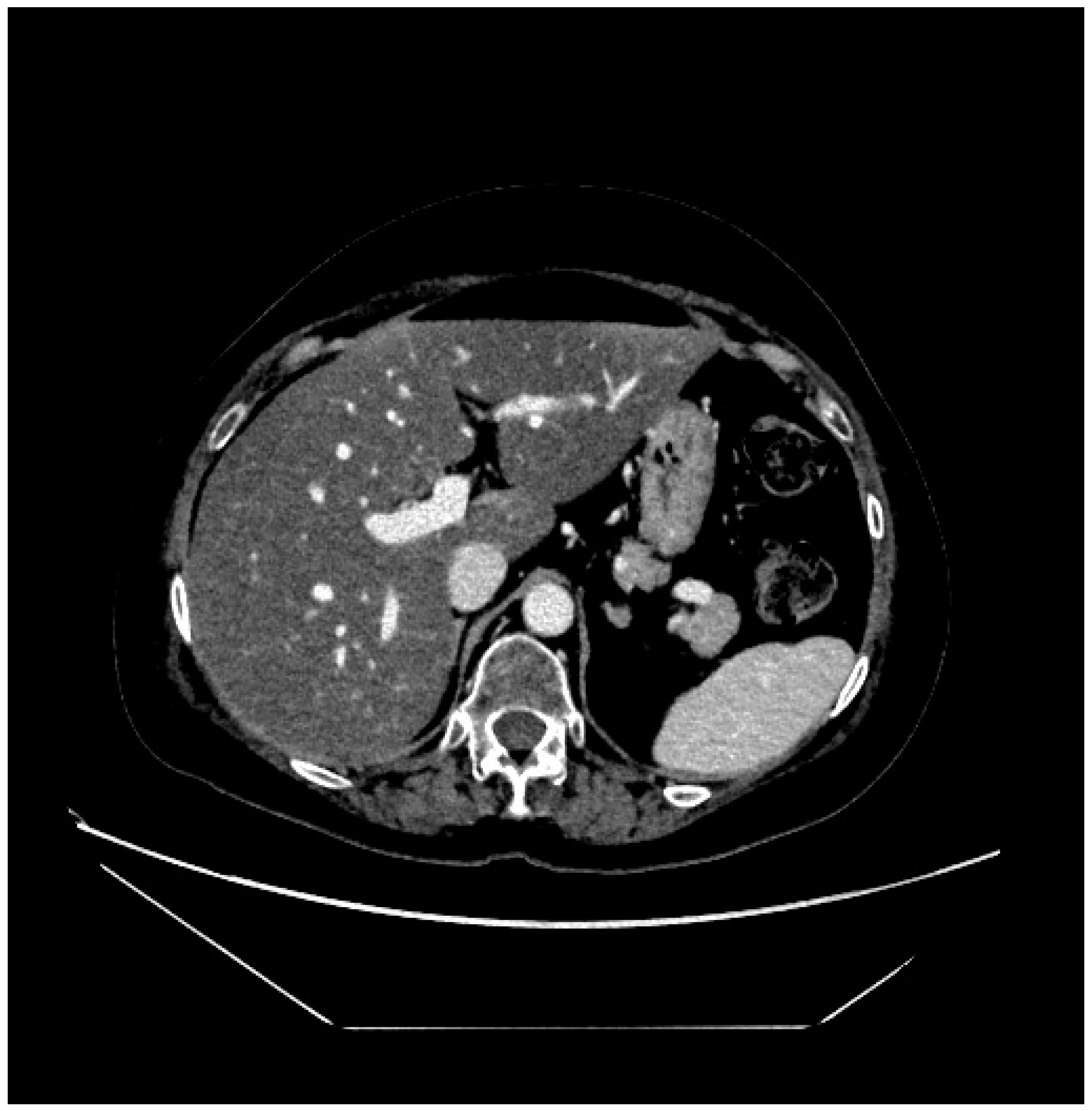 Curroncol 32 00606 g006