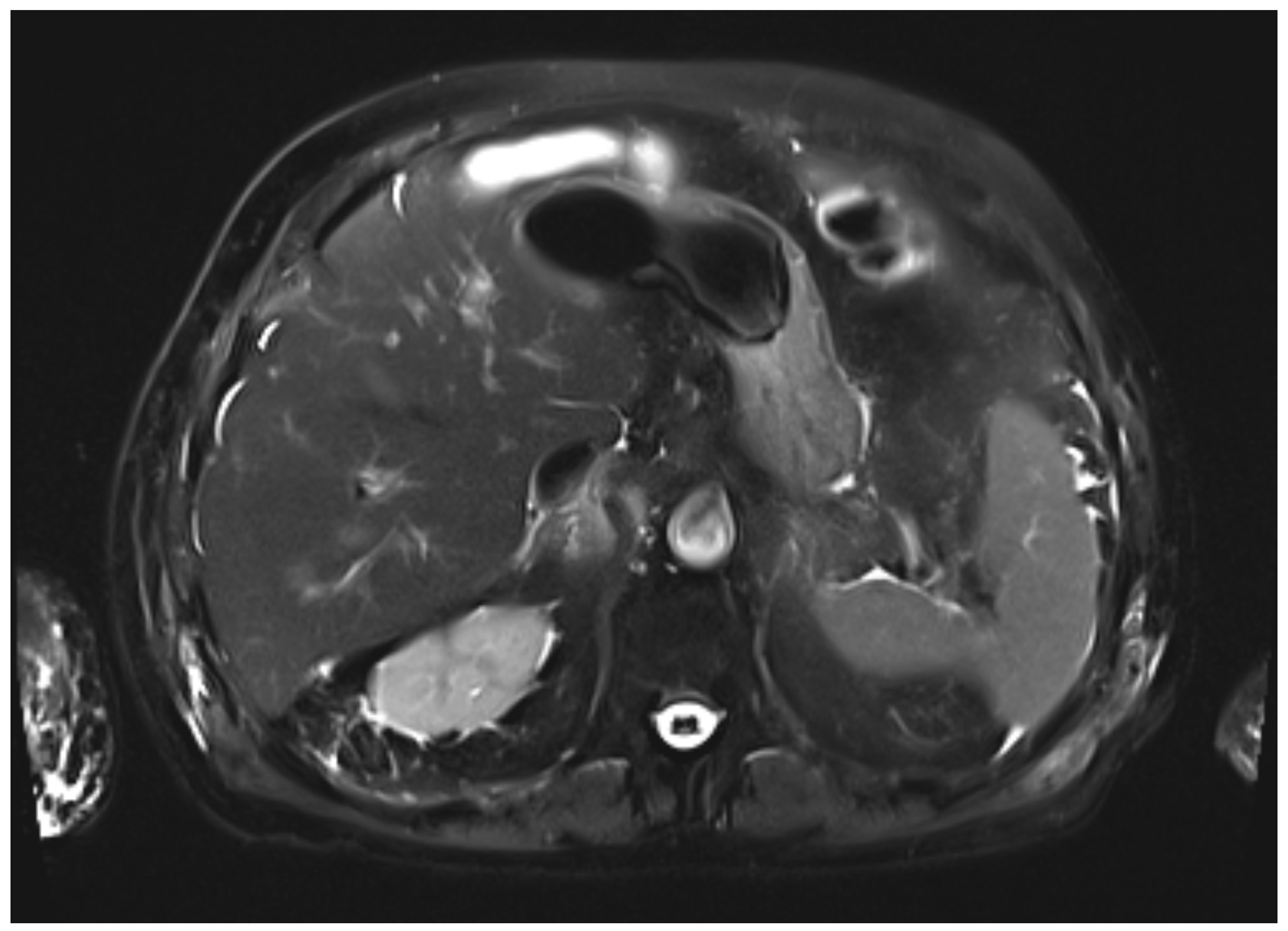 Curroncol 32 00663 g004