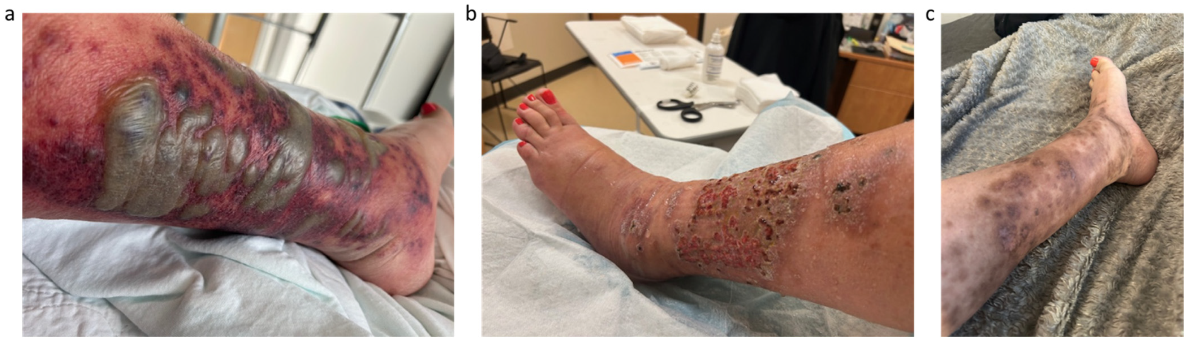 Curroncol 32 00683 g001