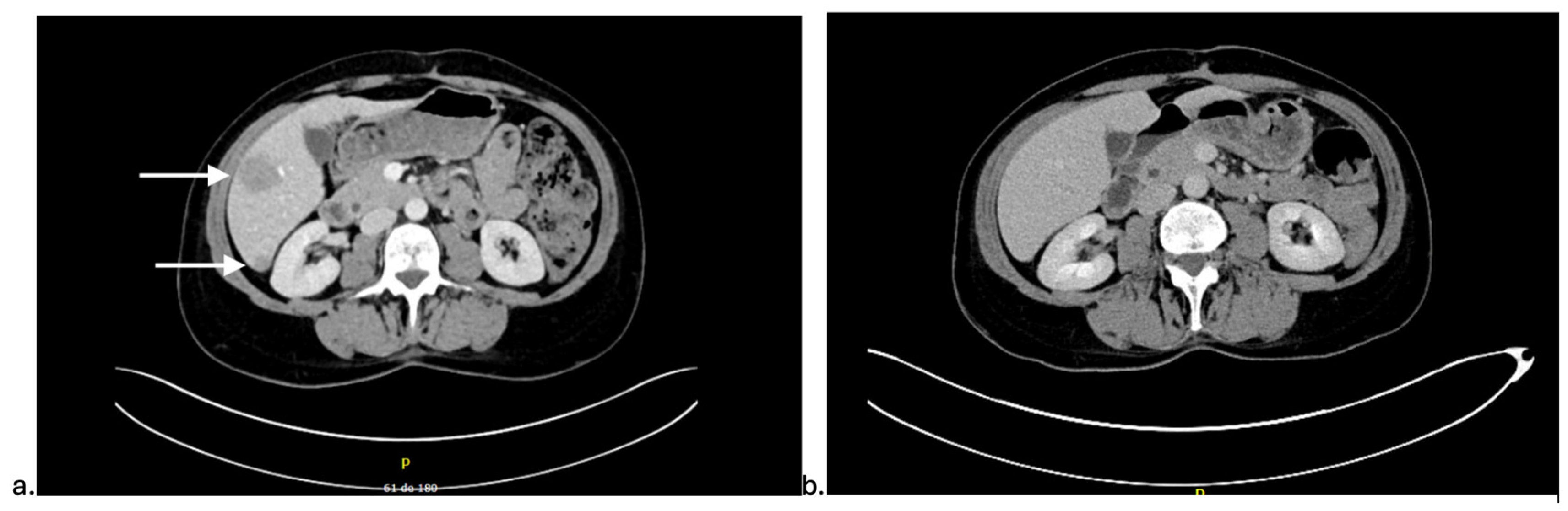 Curroncol 32 00683 g002