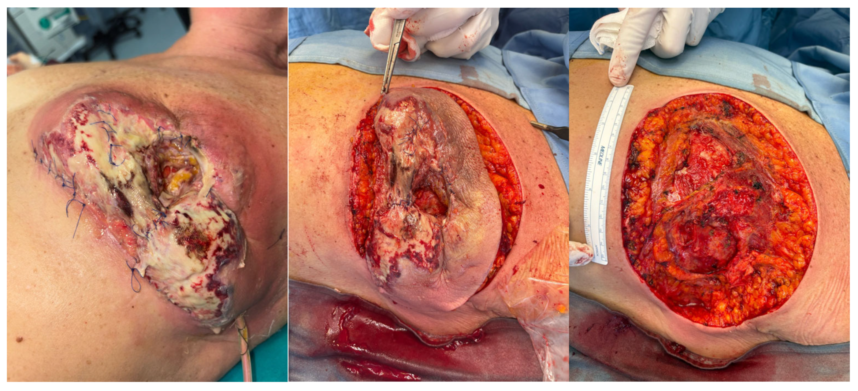 Curroncol 32 00701 g001 Curroncol 32 00701 g001