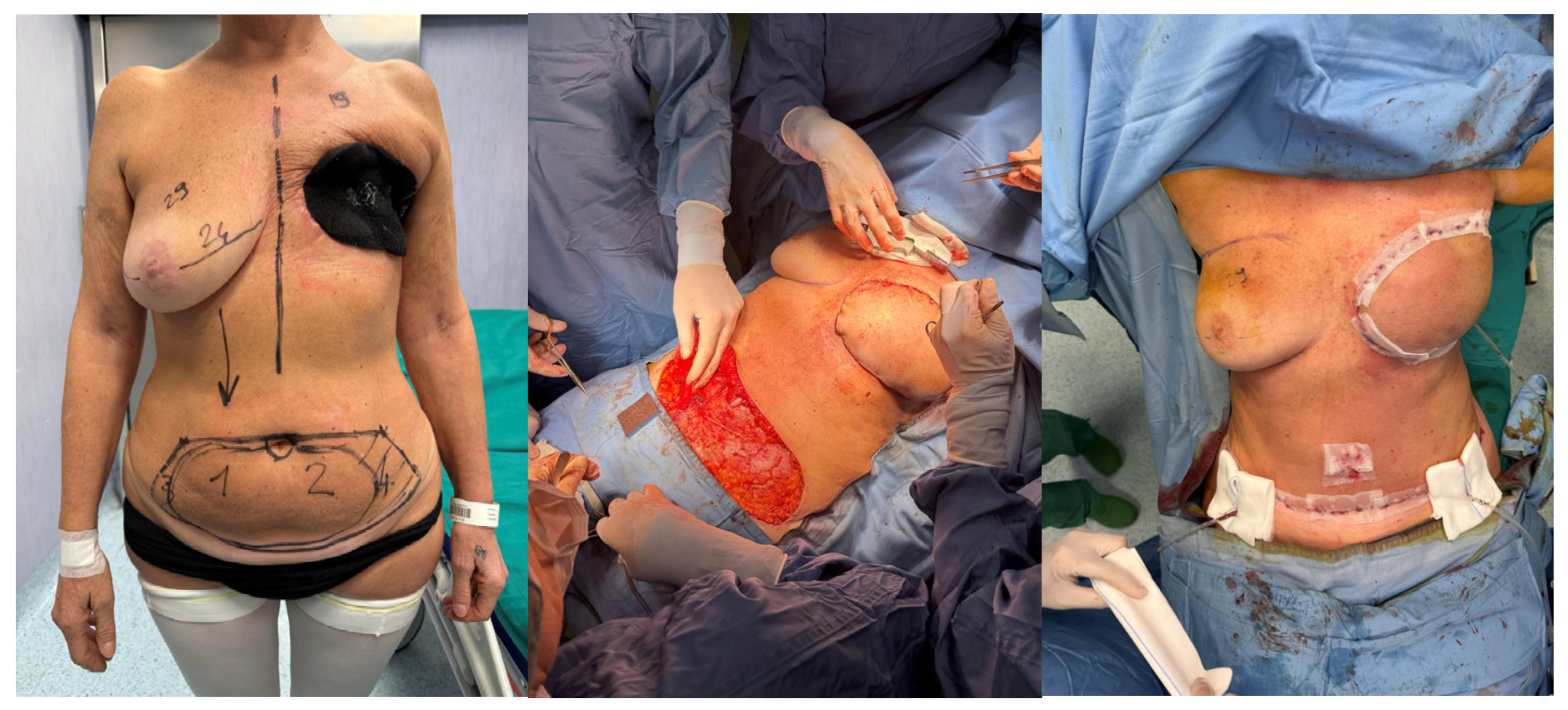 Curroncol 32 00701 g002 Curroncol 32 00701 g002