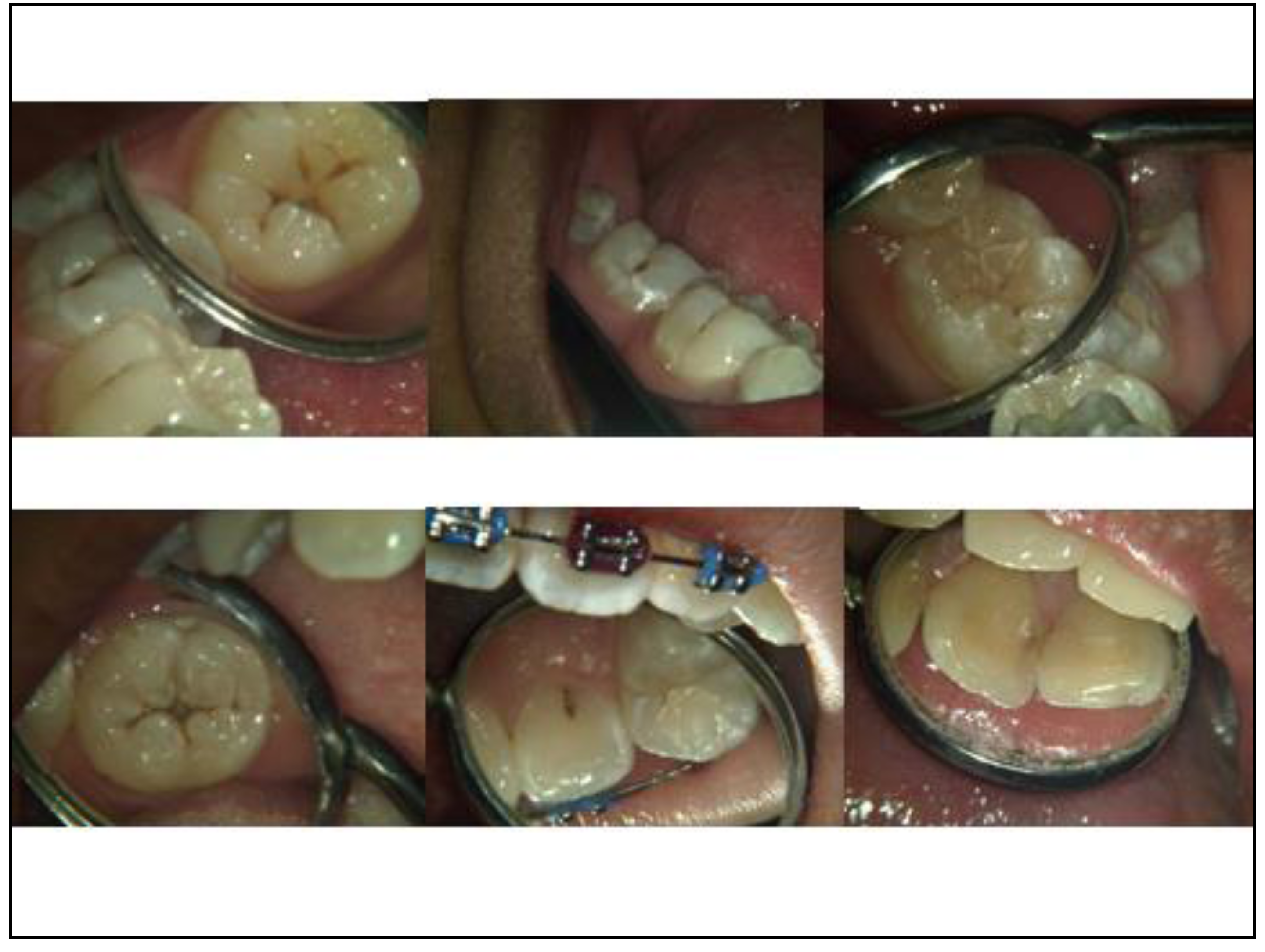 Dentistry 02 00041 g003 1024