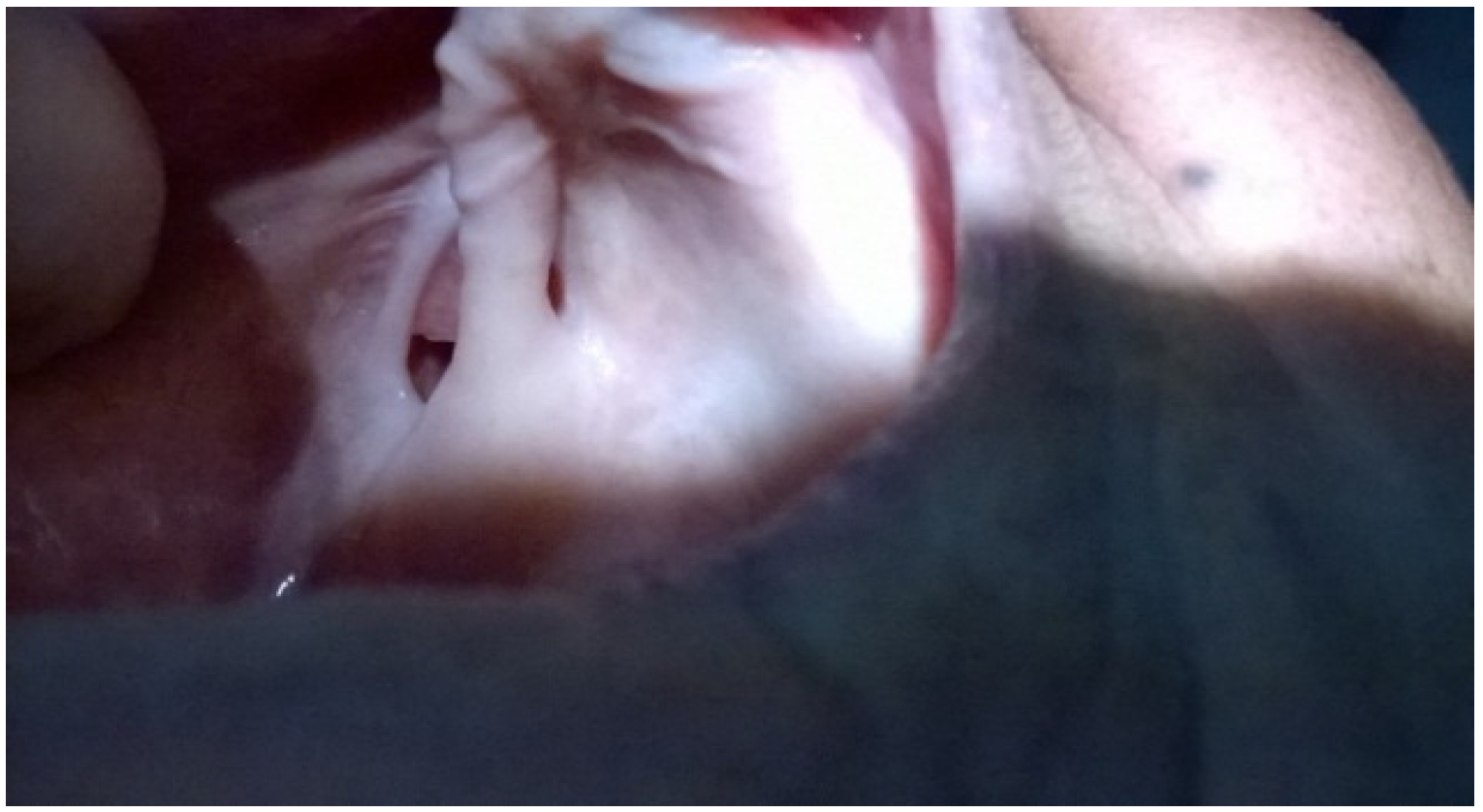 Dentistry 02 00142 g002 1024