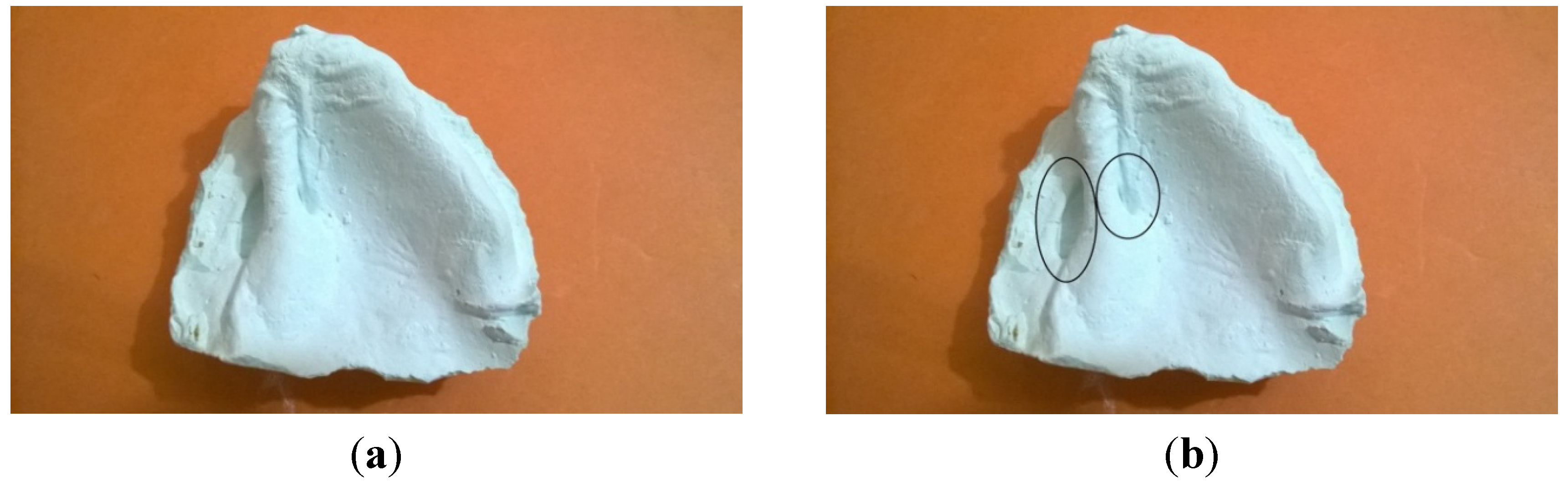 Dentistry 02 00142 g003 1024