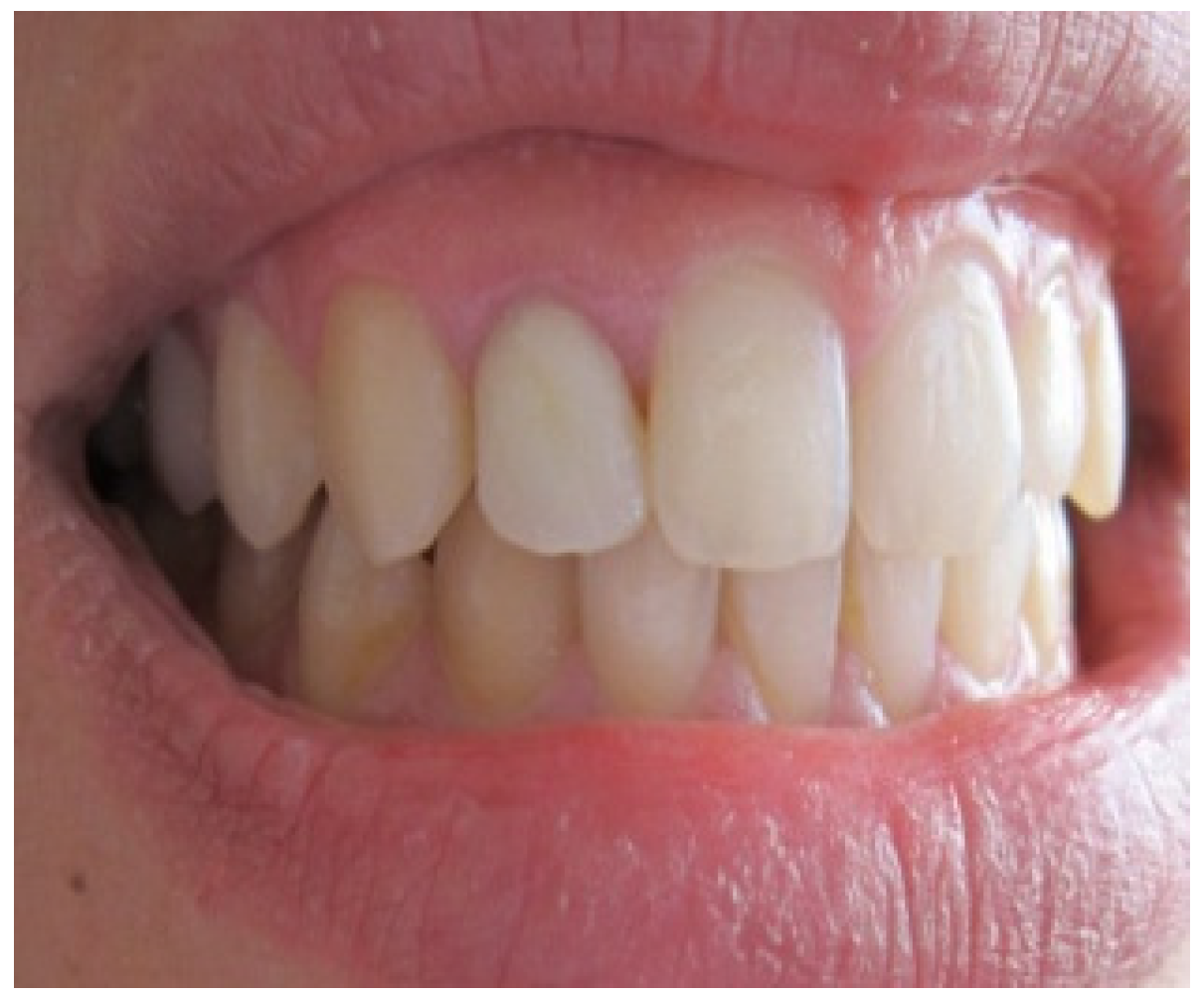 Dentistry 02 00155 g001 1024