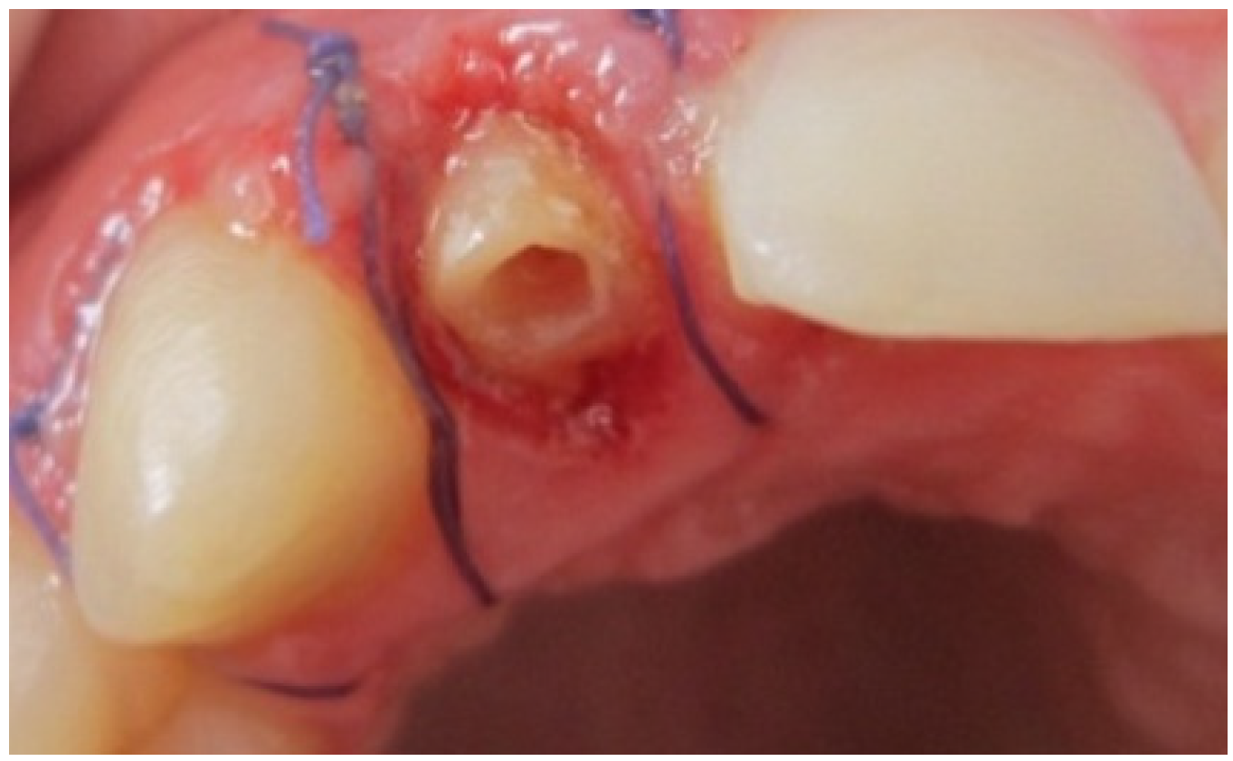 Dentistry 02 00155 g004 1024