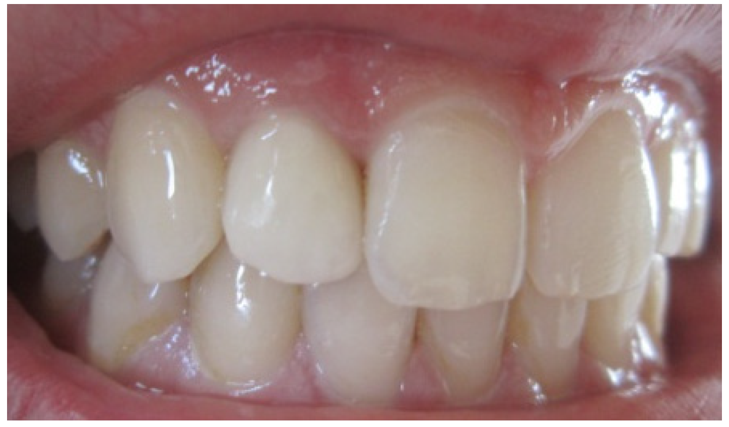 Dentistry 02 00155 g007 1024