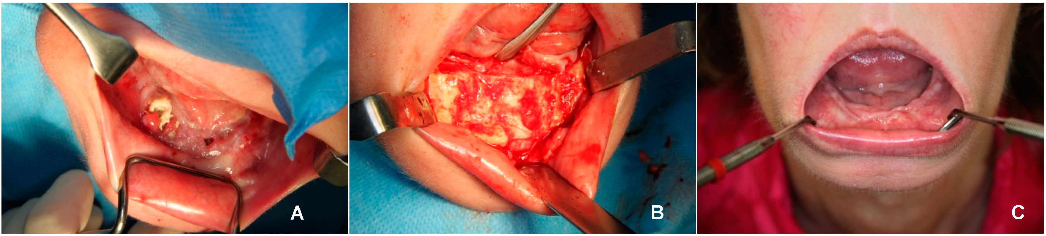 Dentistry 04 00009 g001 1024