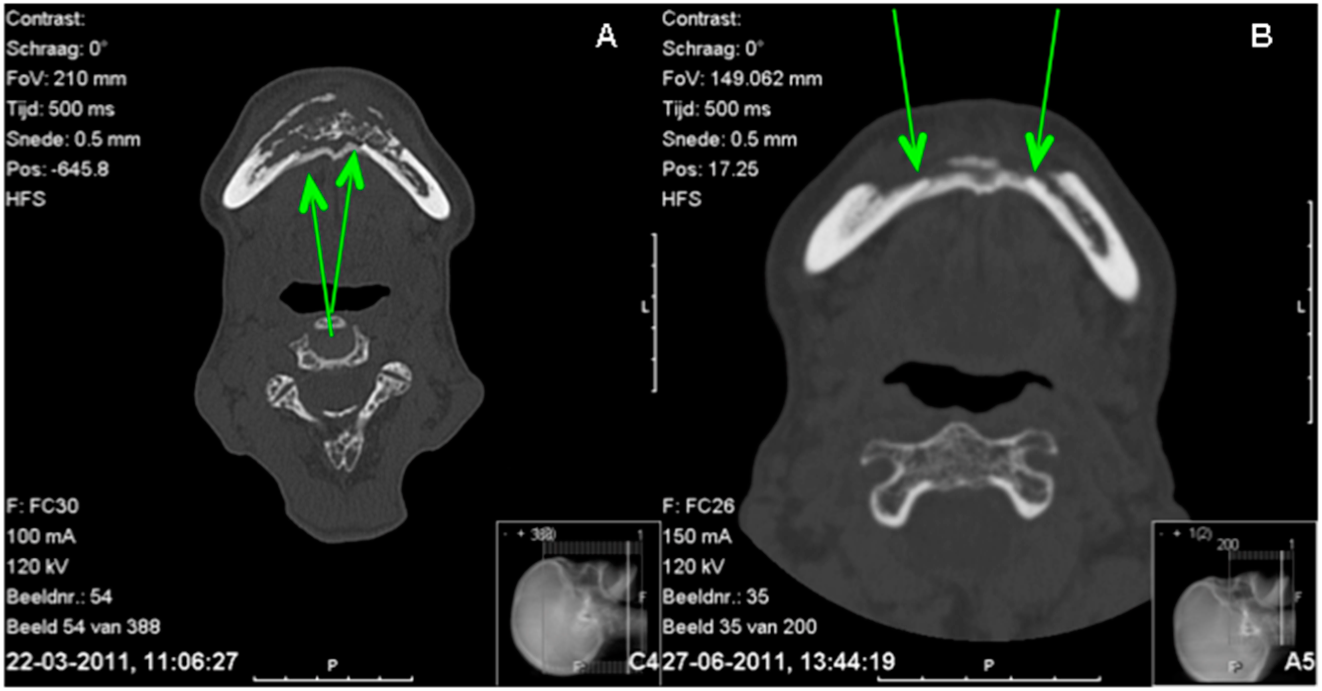 Dentistry 04 00009 g003 1024