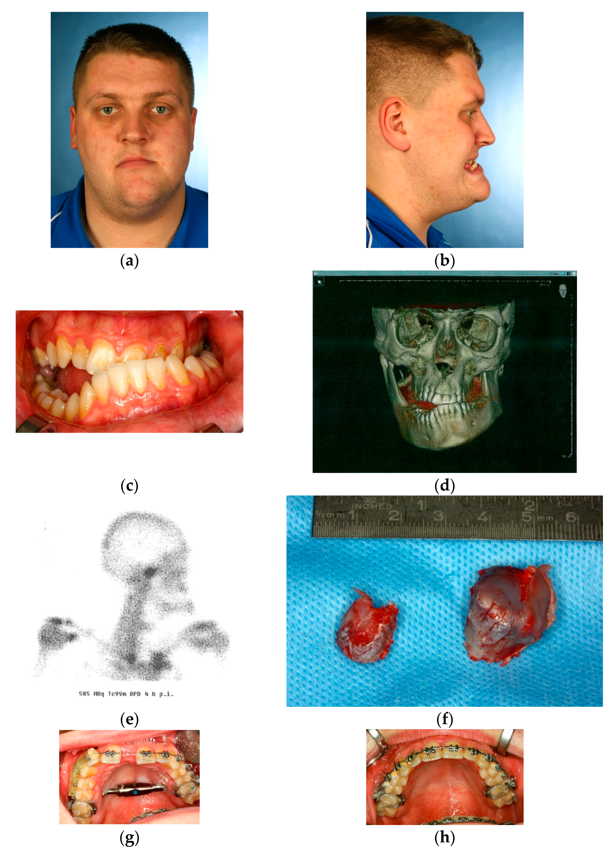 Dentistry 04 00011 g001a 1024