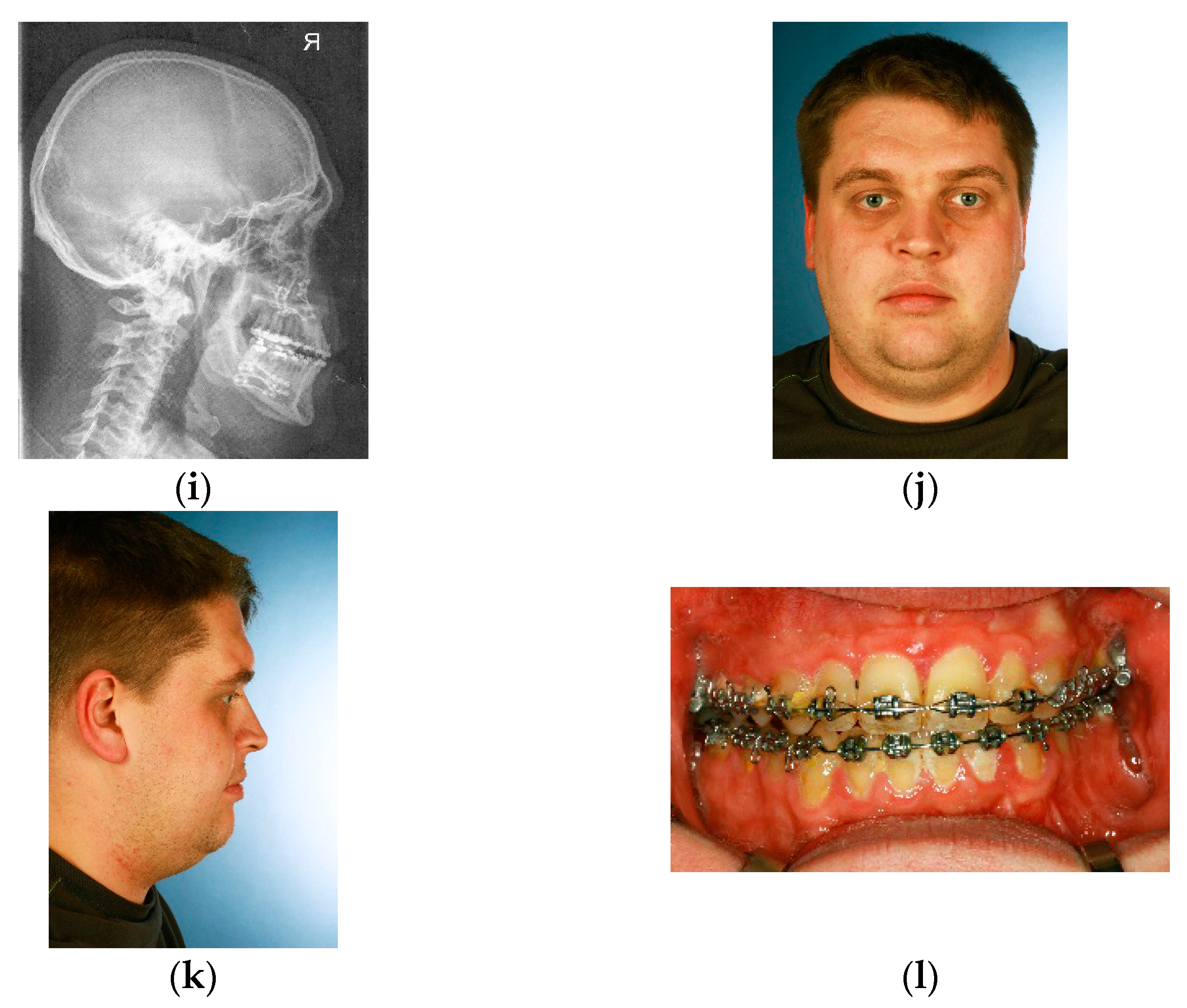 Dentistry 04 00011 g001b 1024