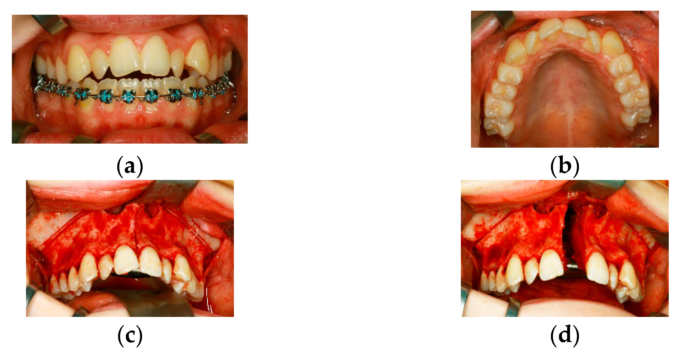 Dentistry 04 00011 g002a 1024