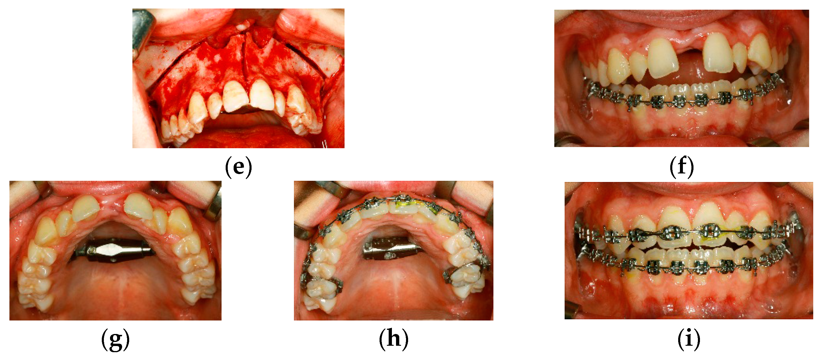 Dentistry 04 00011 g002b 1024