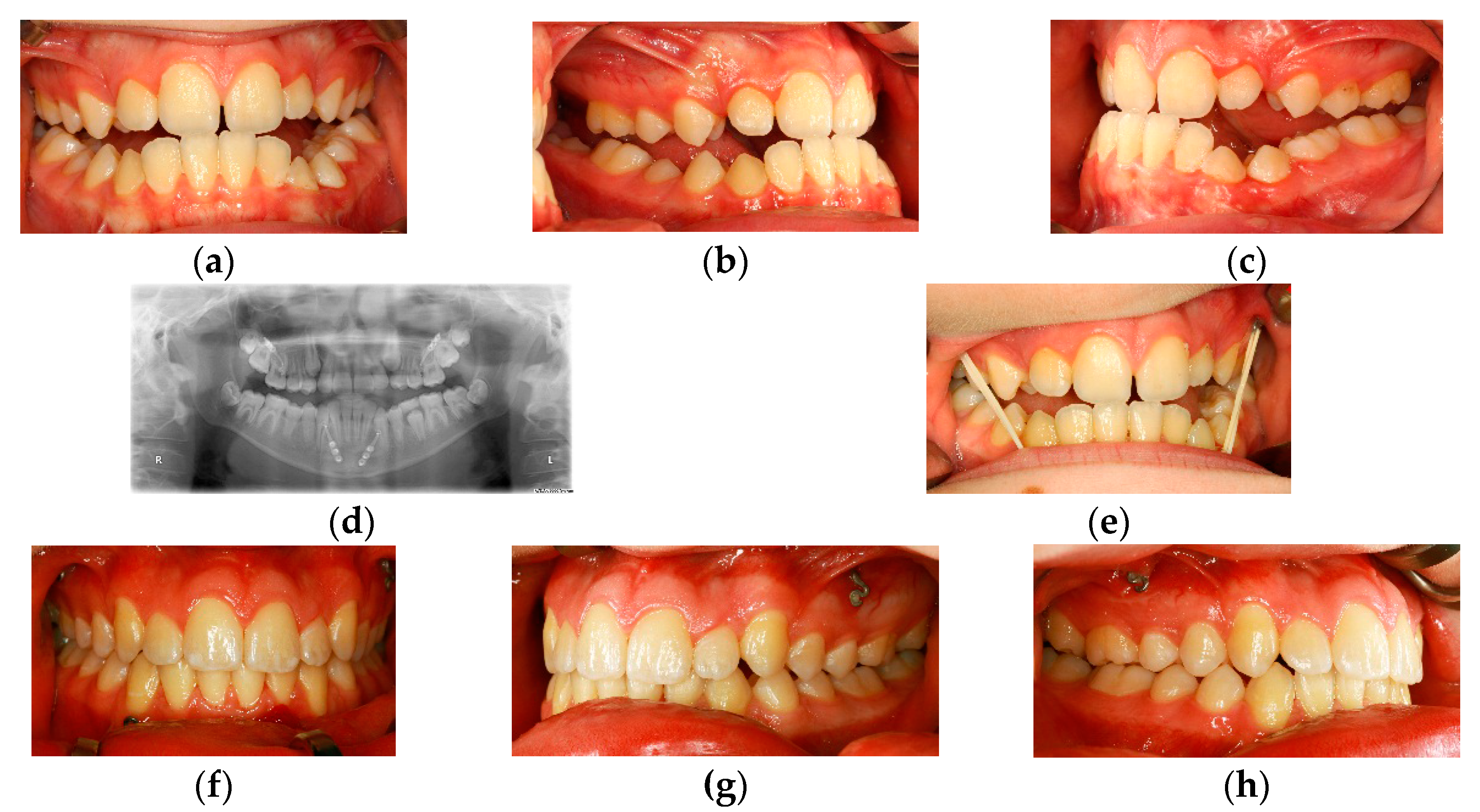 Dentistry 04 00011 g003 1024