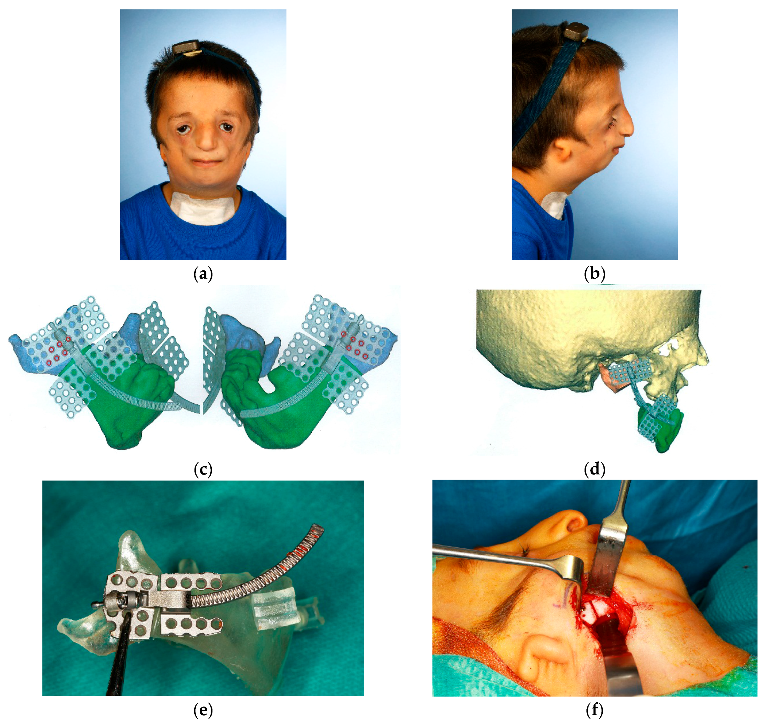 Dentistry 04 00011 g004a 1024