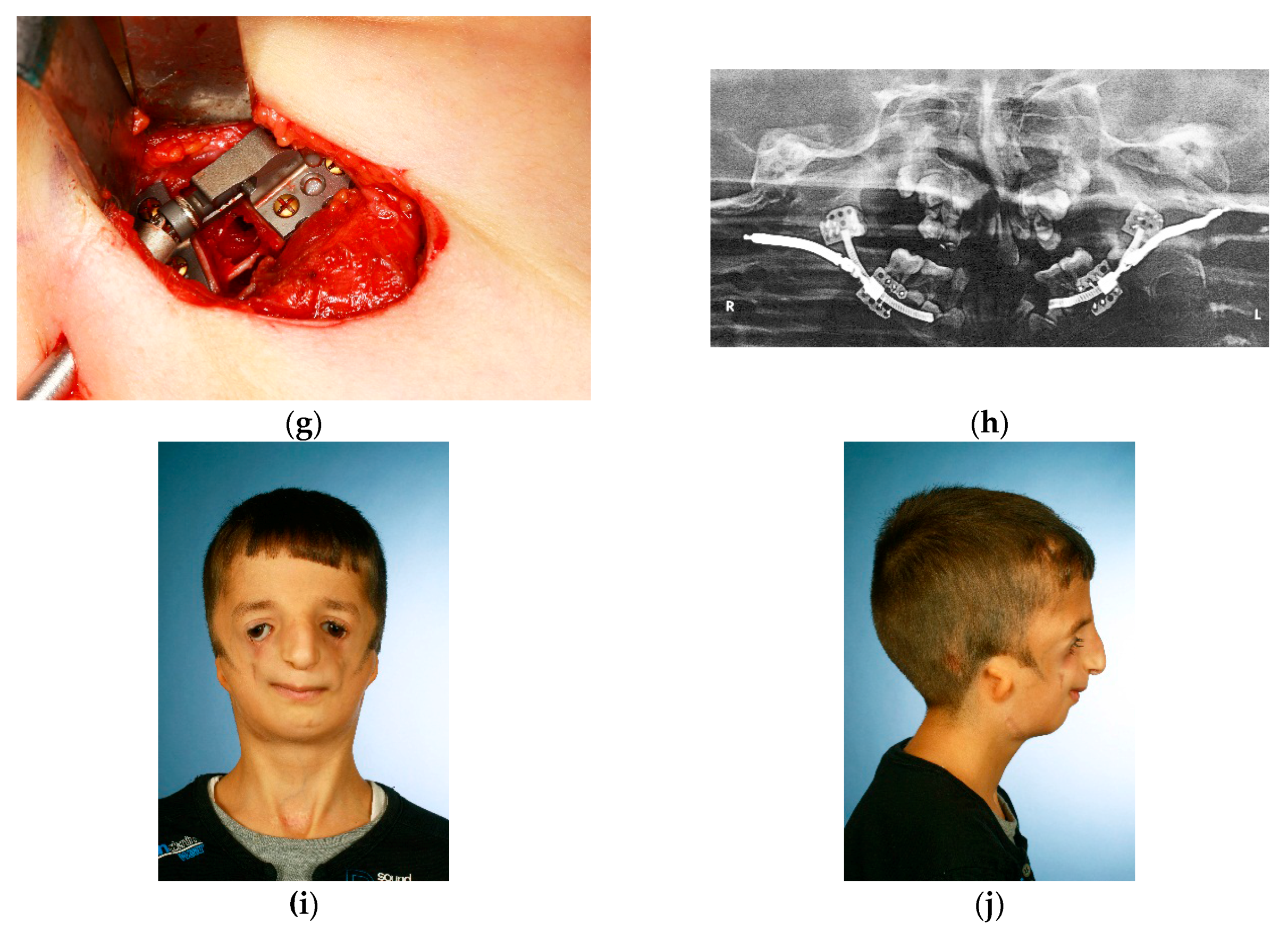 Dentistry 04 00011 g004b 1024