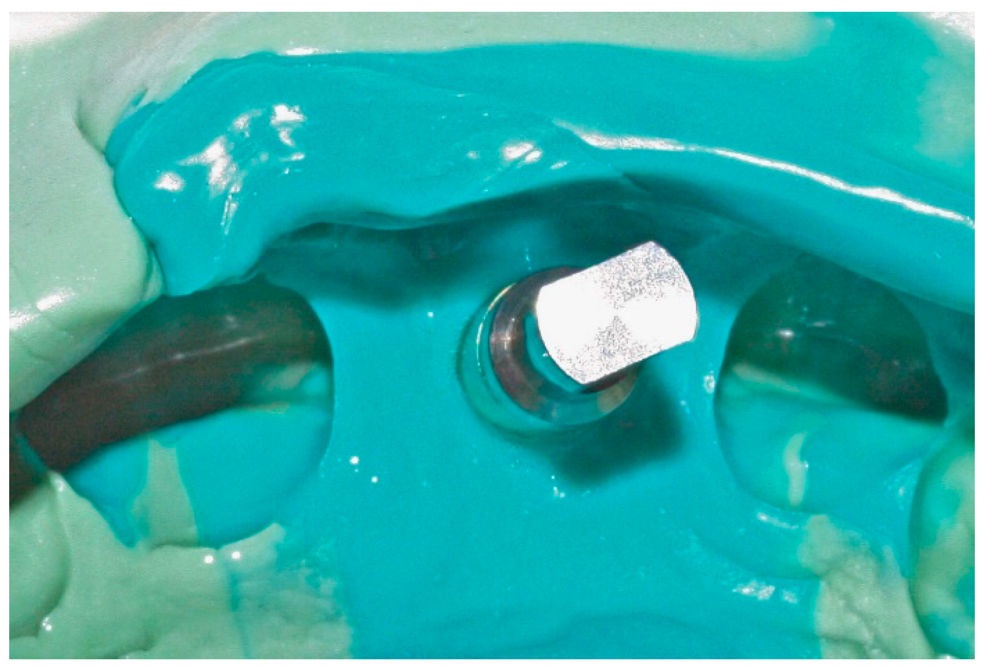 Dentistry 04 00014 g003 1024