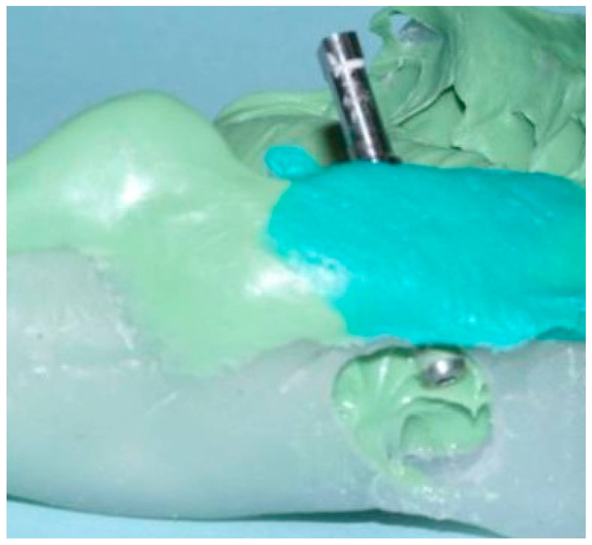 Dentistry 04 00014 g004 1024