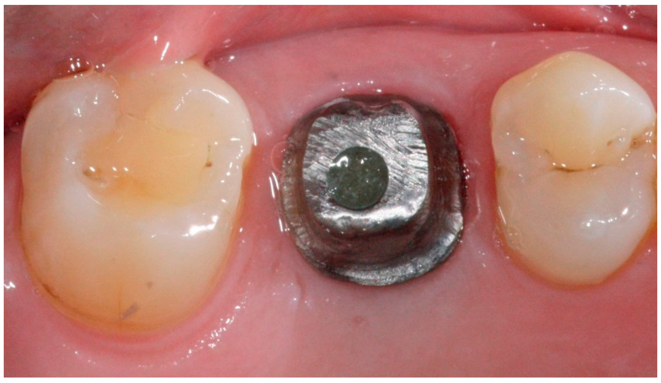 Dentistry 04 00014 g006 1024