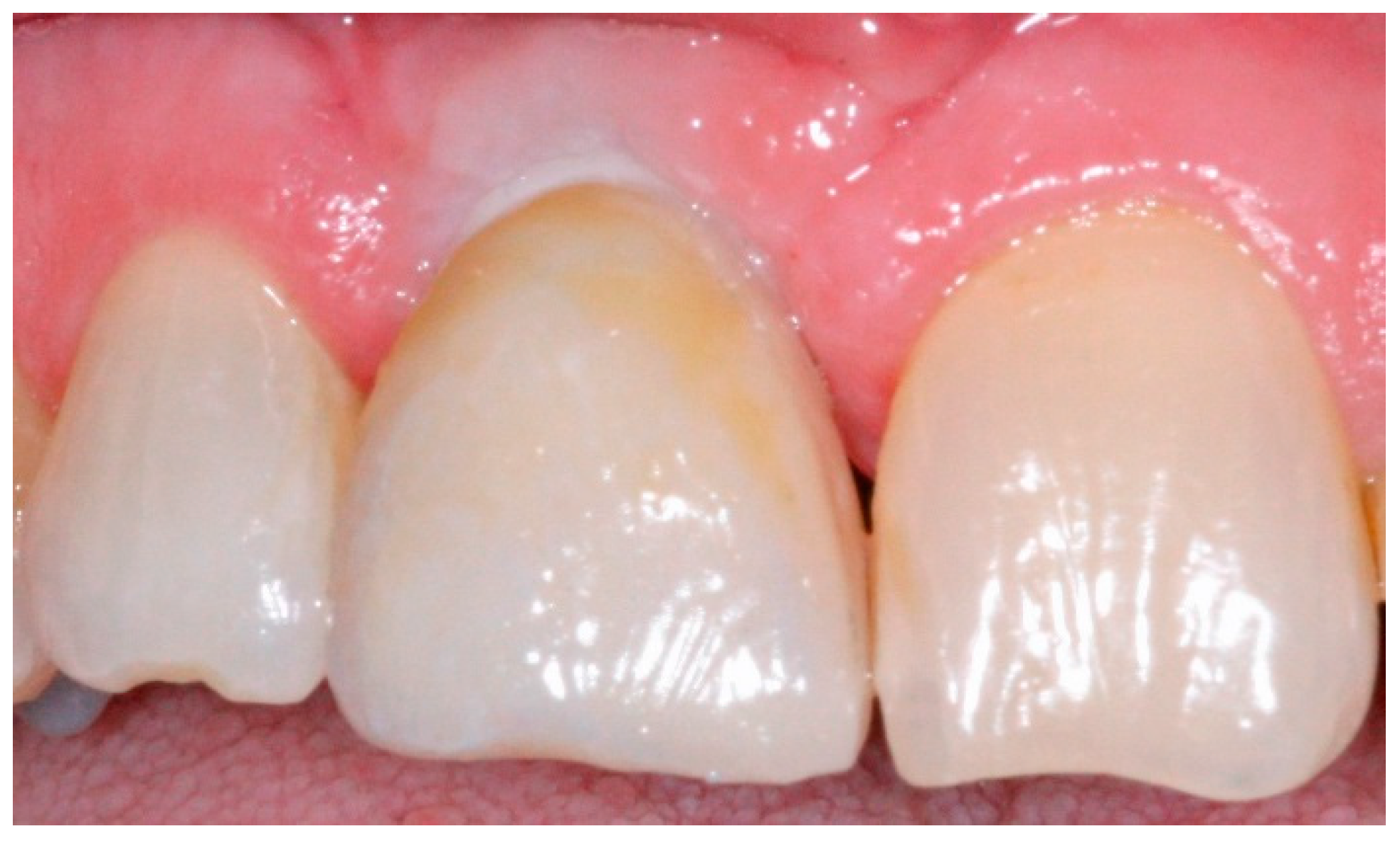 Dentistry 04 00014 g007 1024